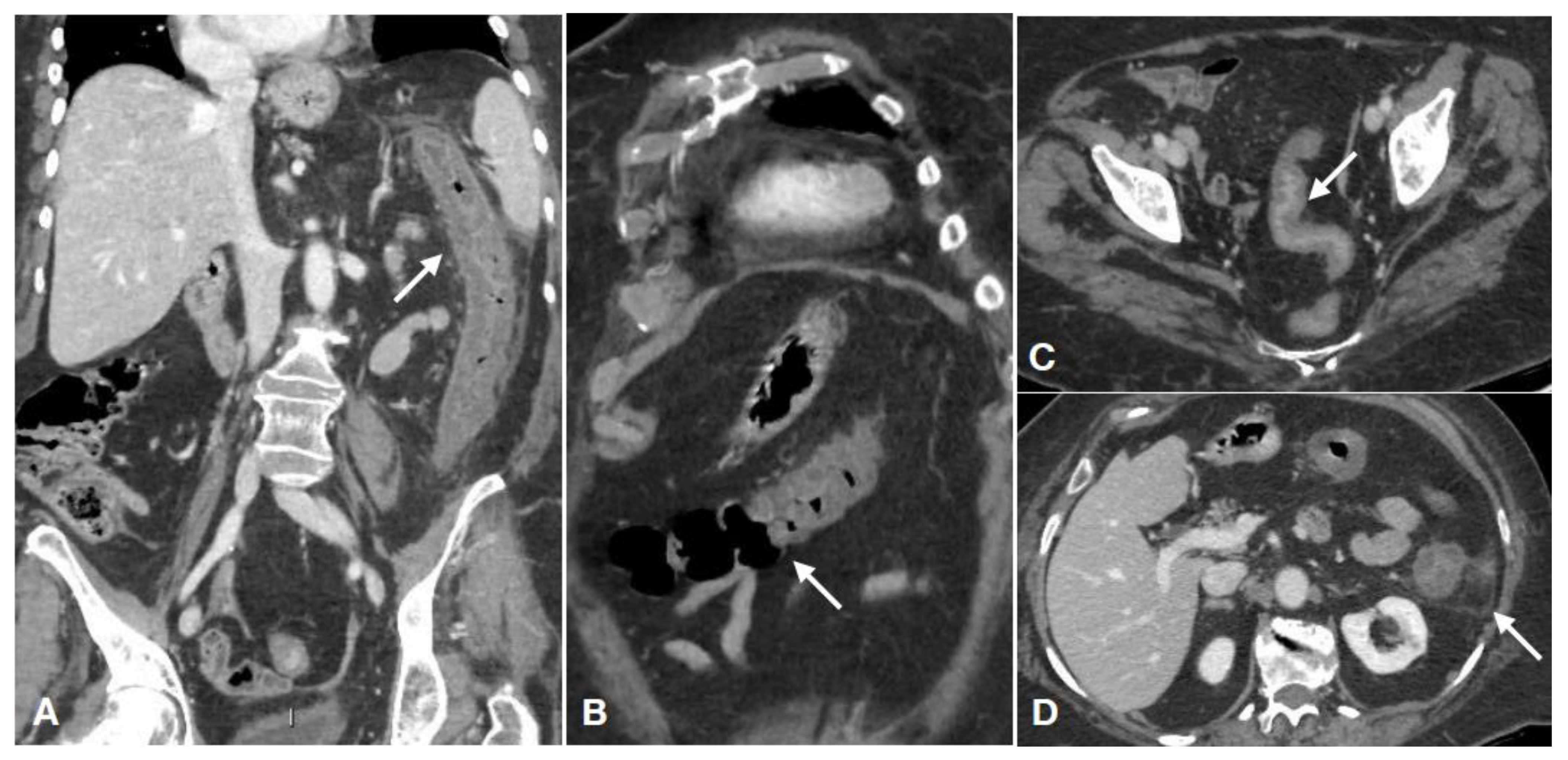 Diagnostics 11 00998 g001