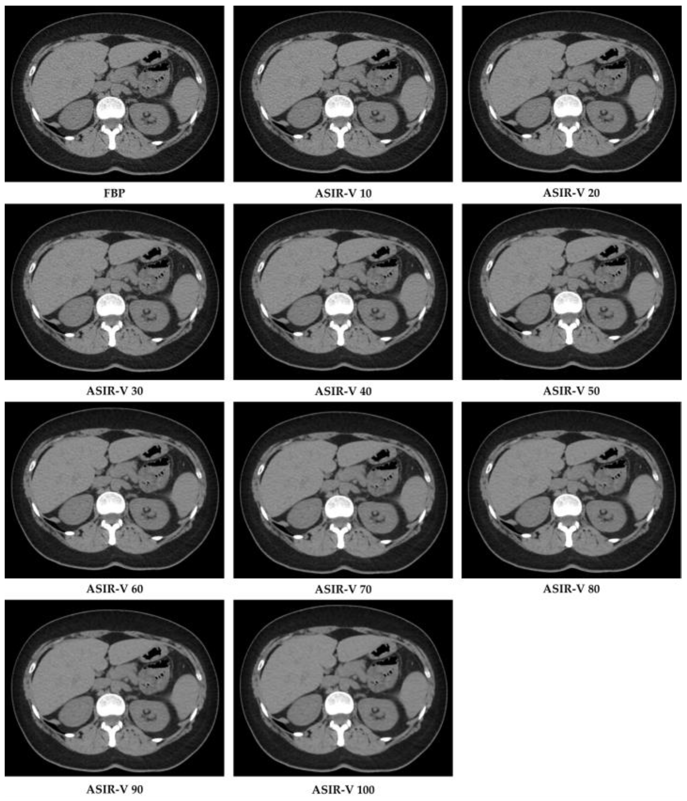 Diagnostics 11 01000 g002 Diagnostics 11 01000 g002