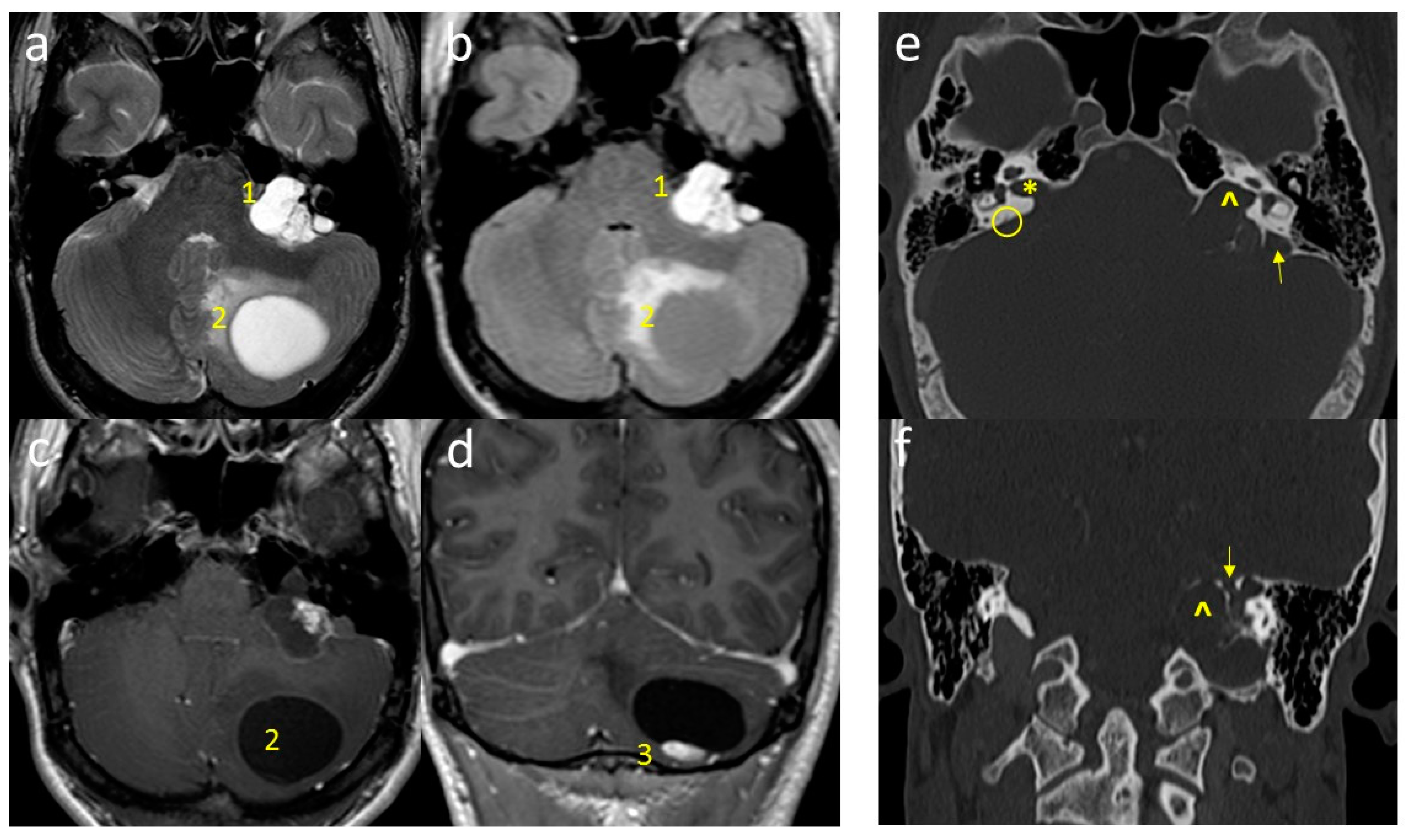 Diagnostics 11 01005 g001