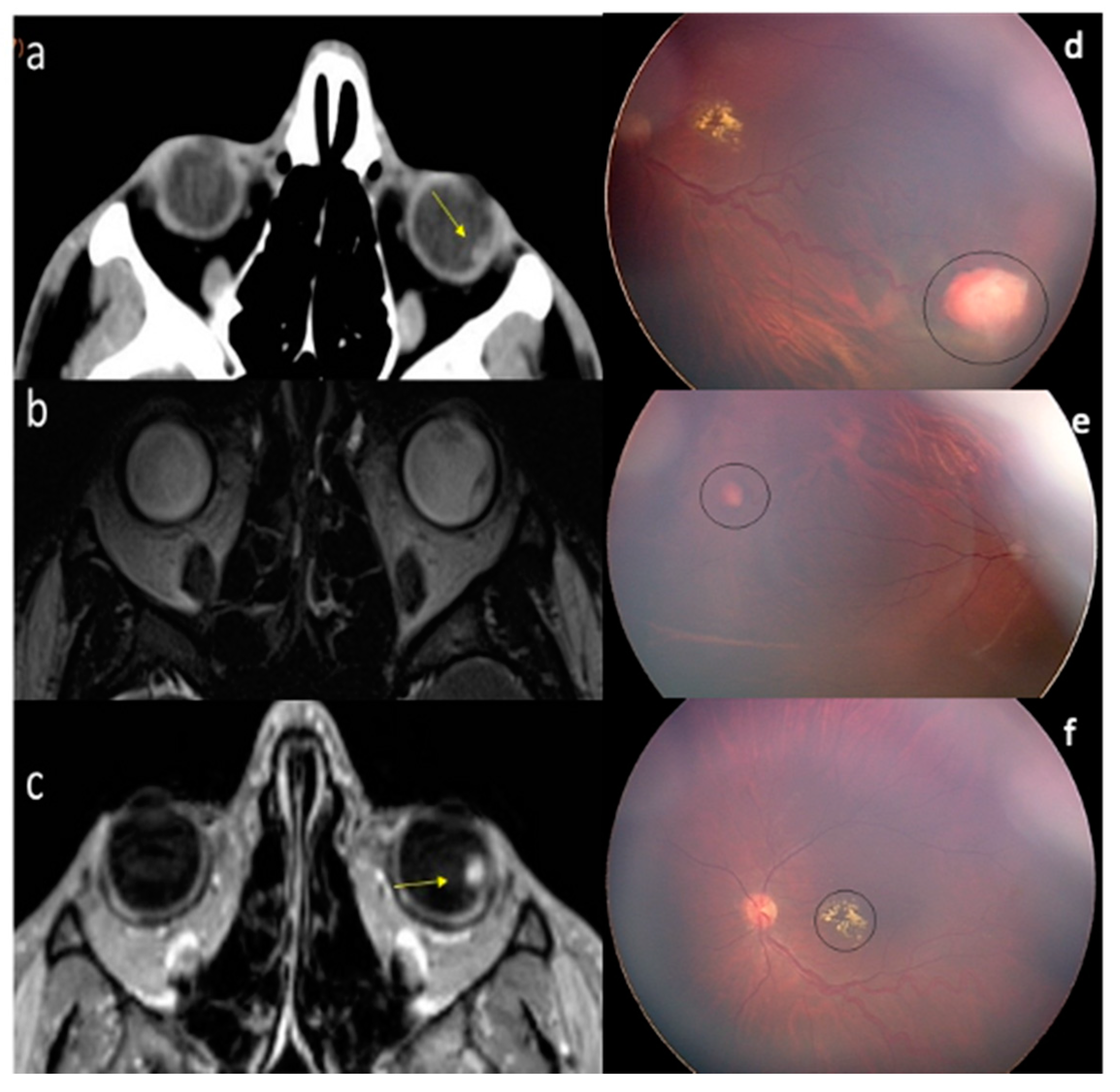 Diagnostics 11 01005 g002