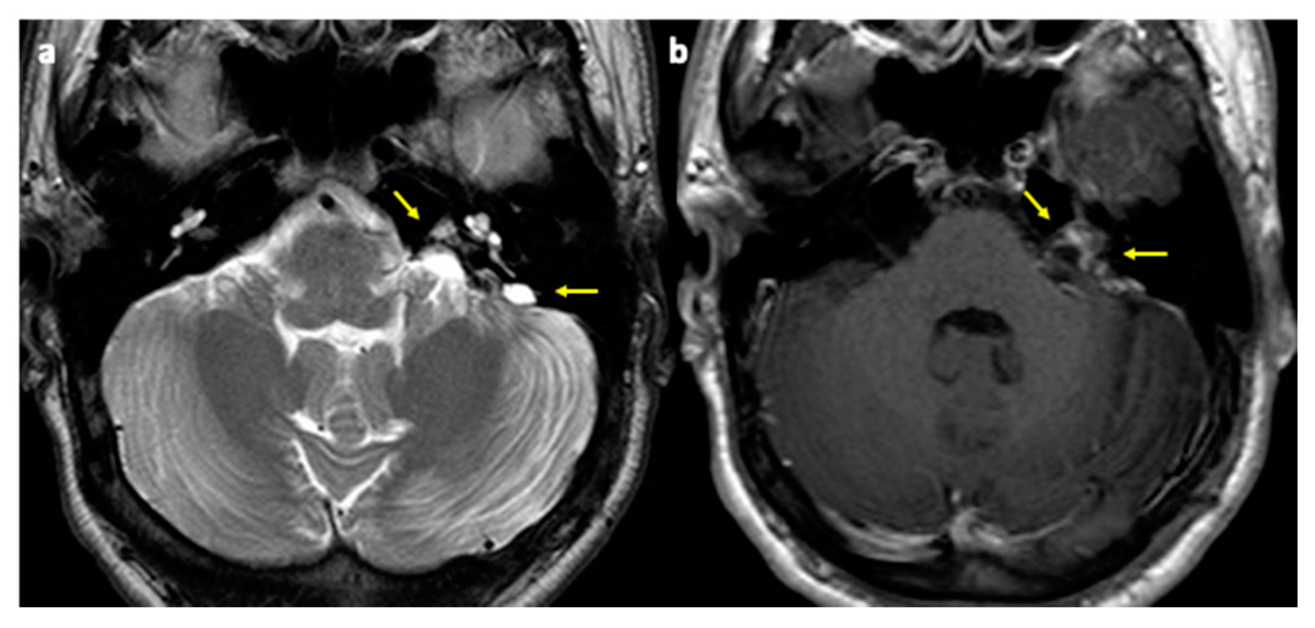 Diagnostics 11 01005 g003
