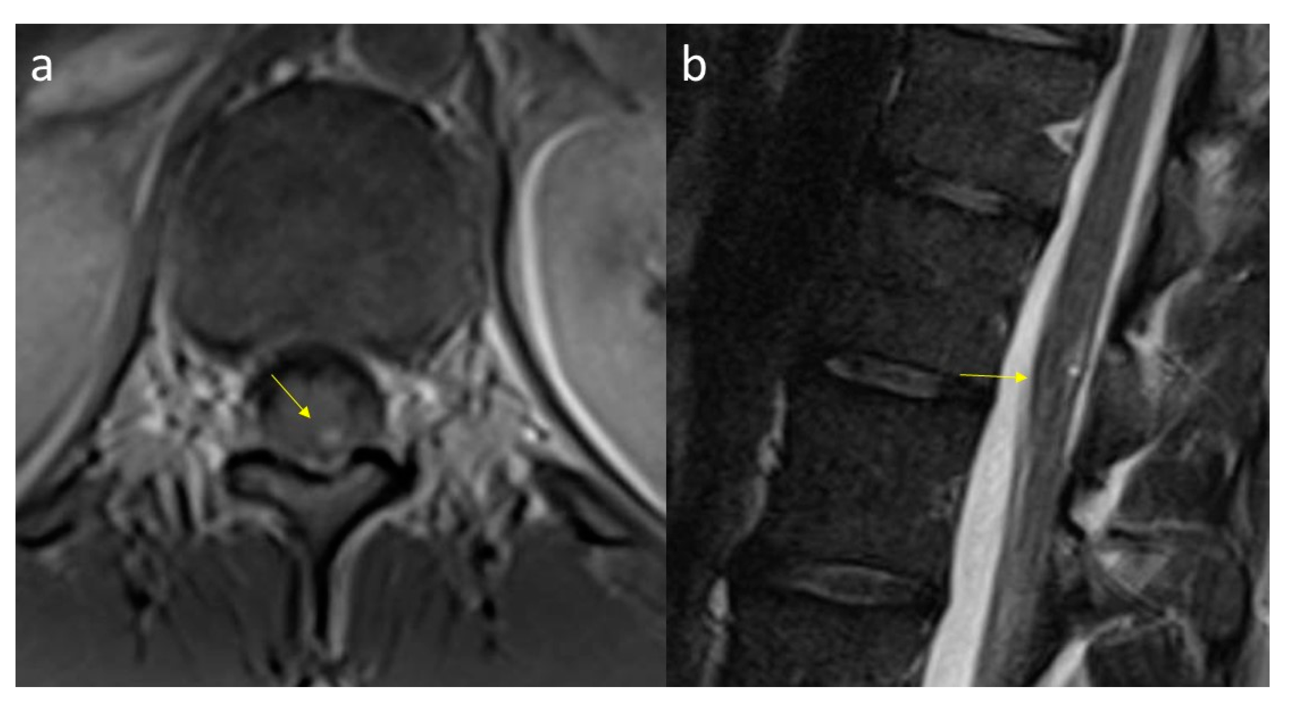 Diagnostics 11 01005 g005