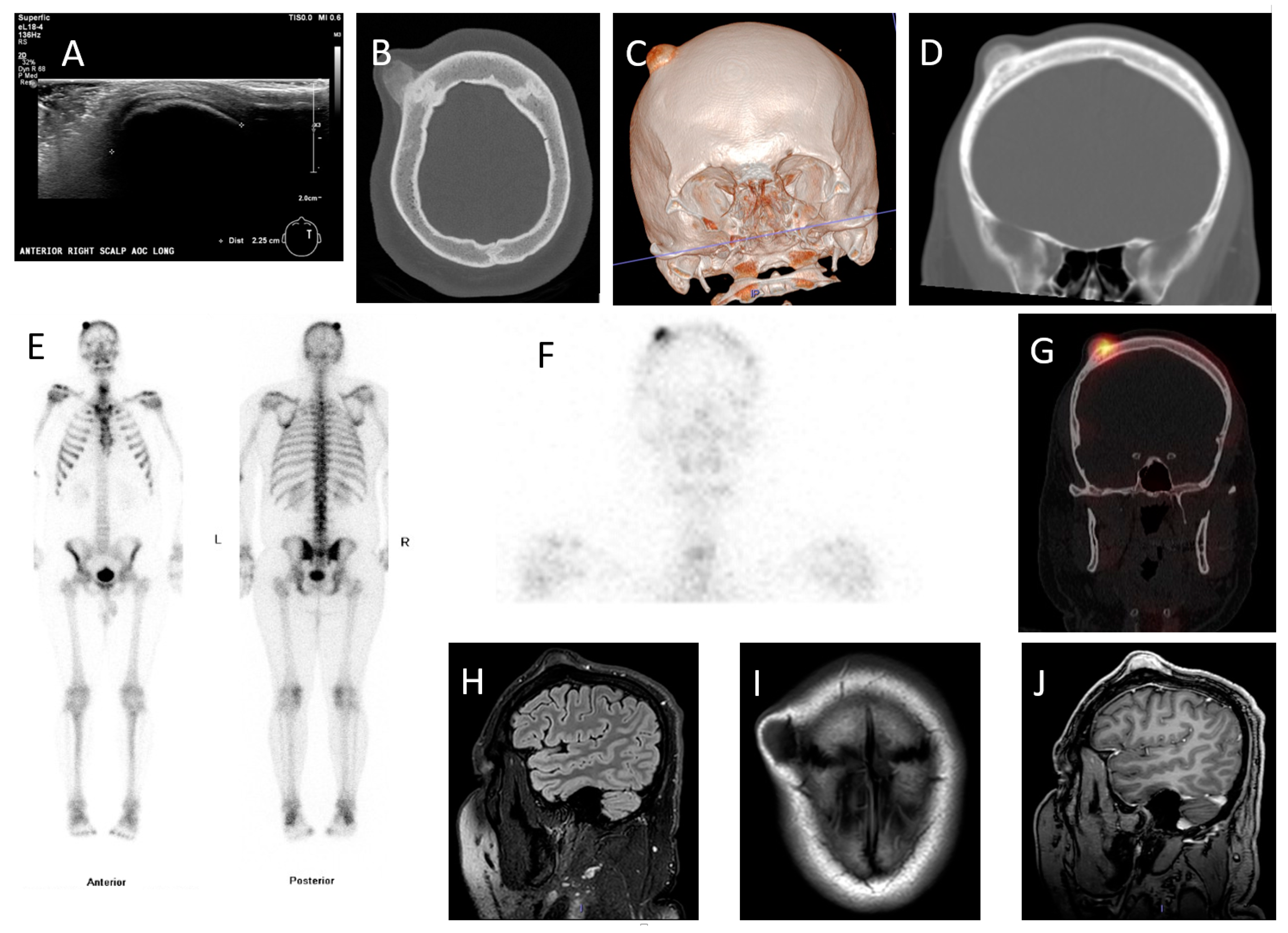 Diagnostics 11 01006 g001a