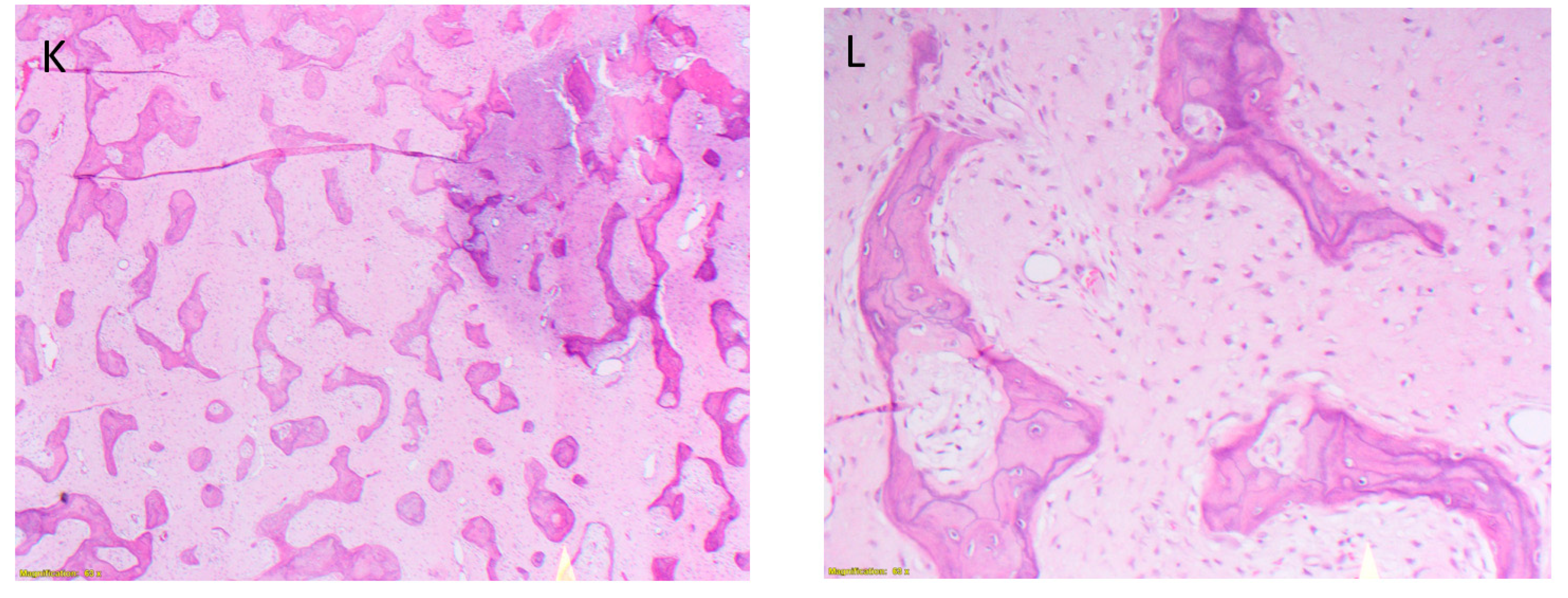 Diagnostics 11 01006 g001b