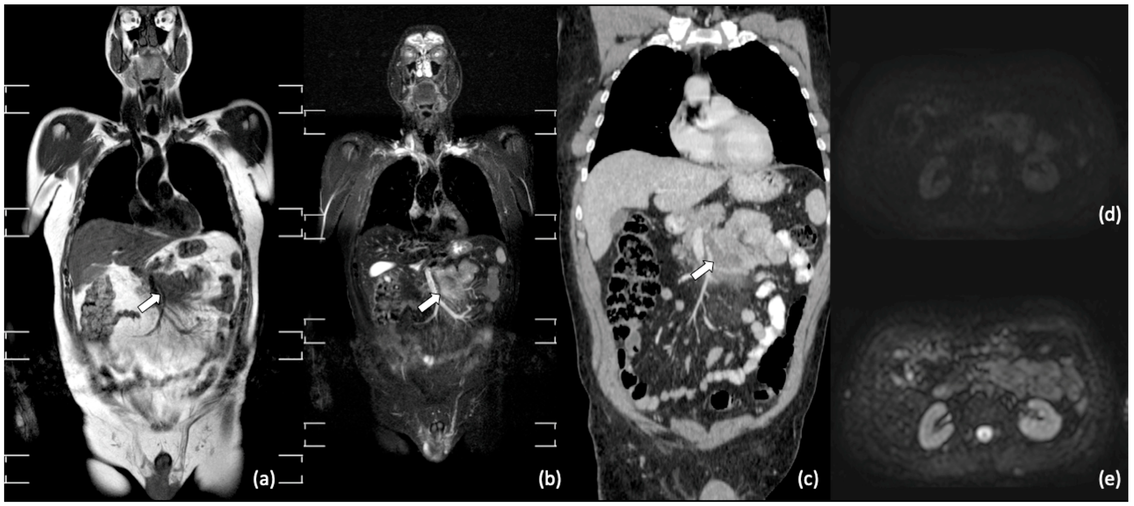 Diagnostics 11 01007 g003