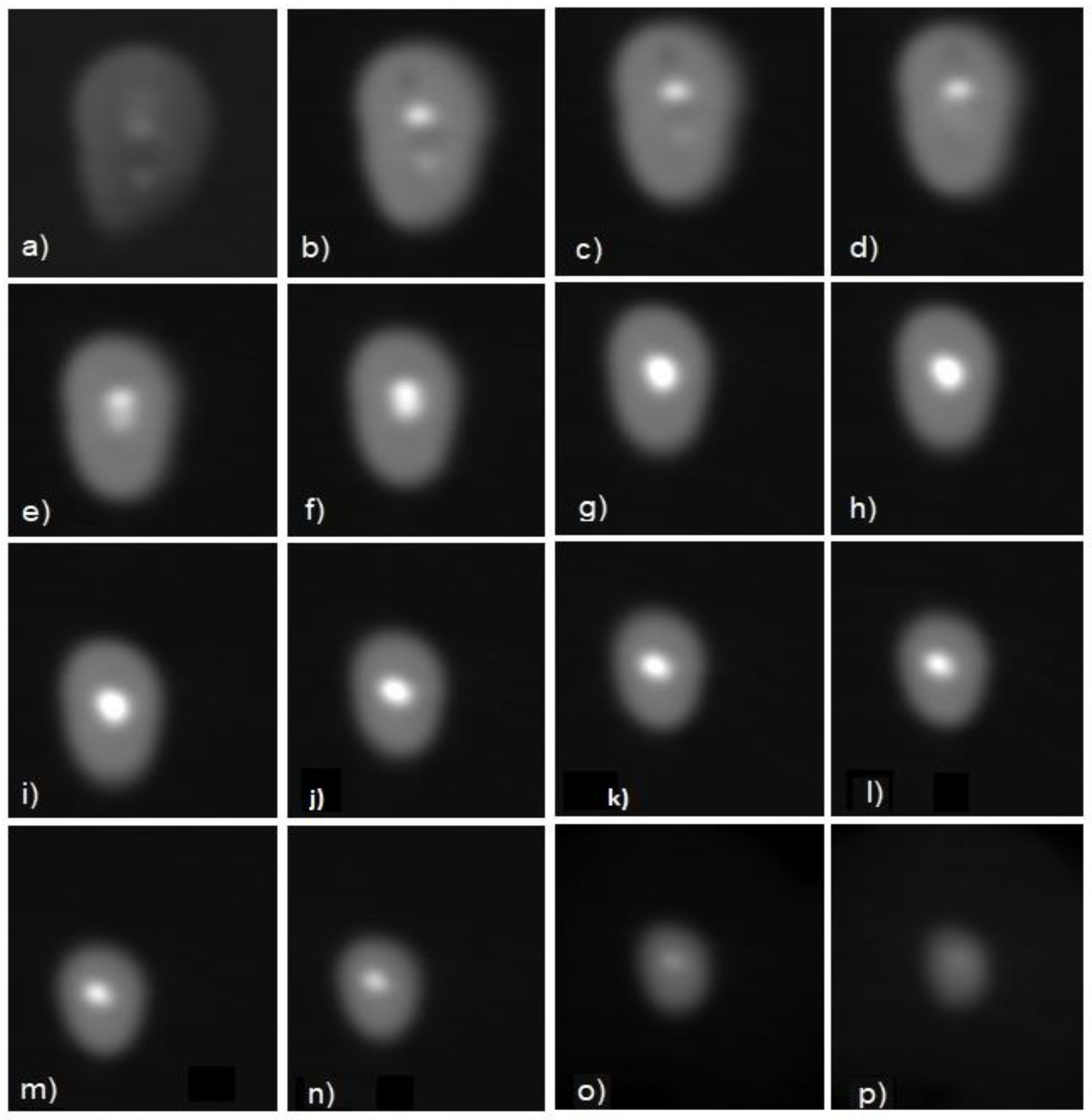 Diagnostics 11 01012 g001
