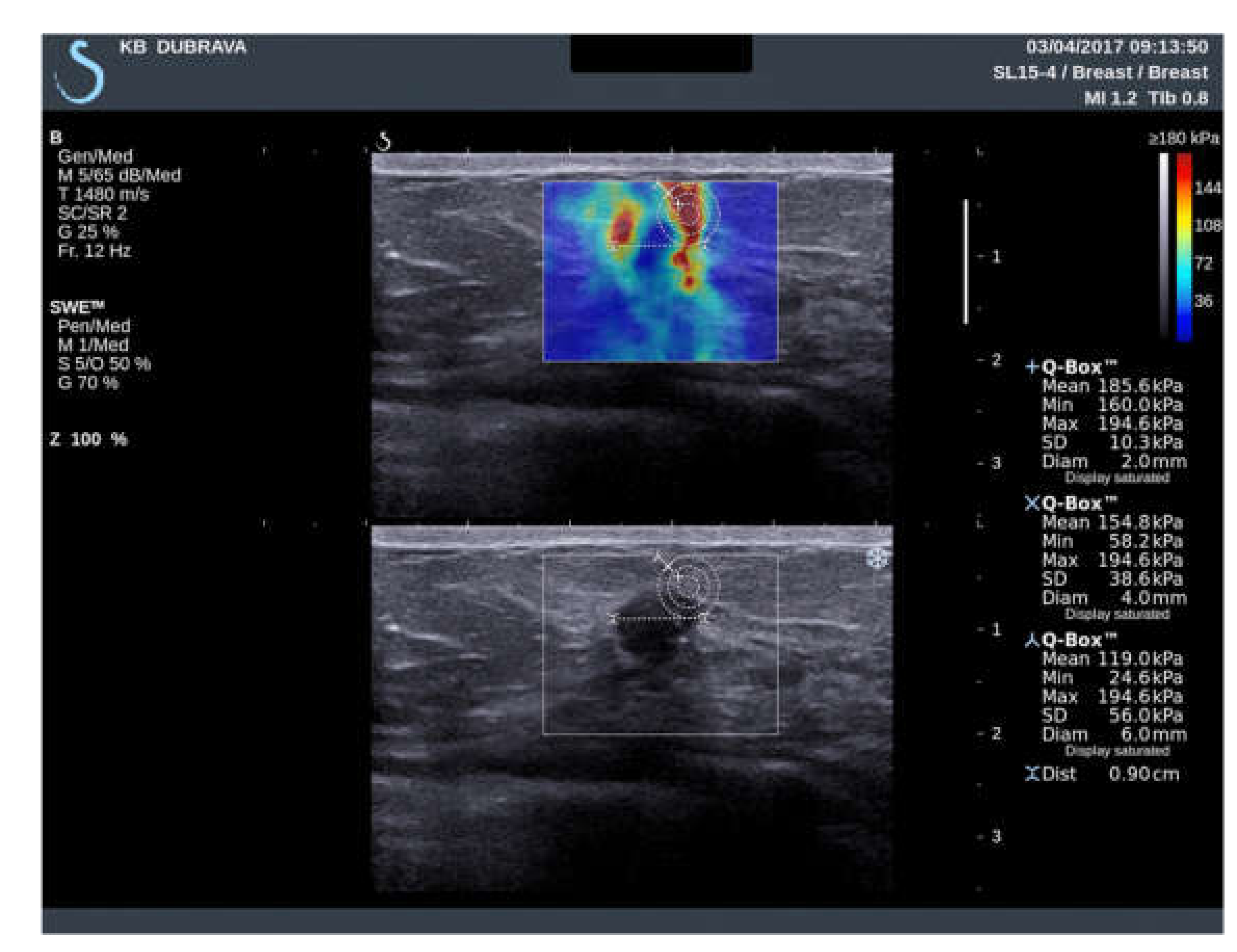 Diagnostics 11 01015 g002