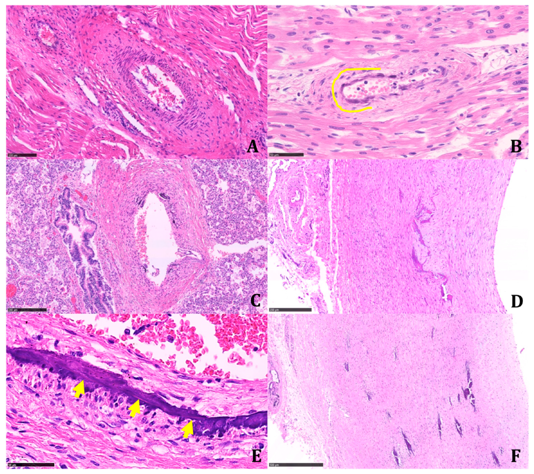 Diagnostics 11 01034 g004