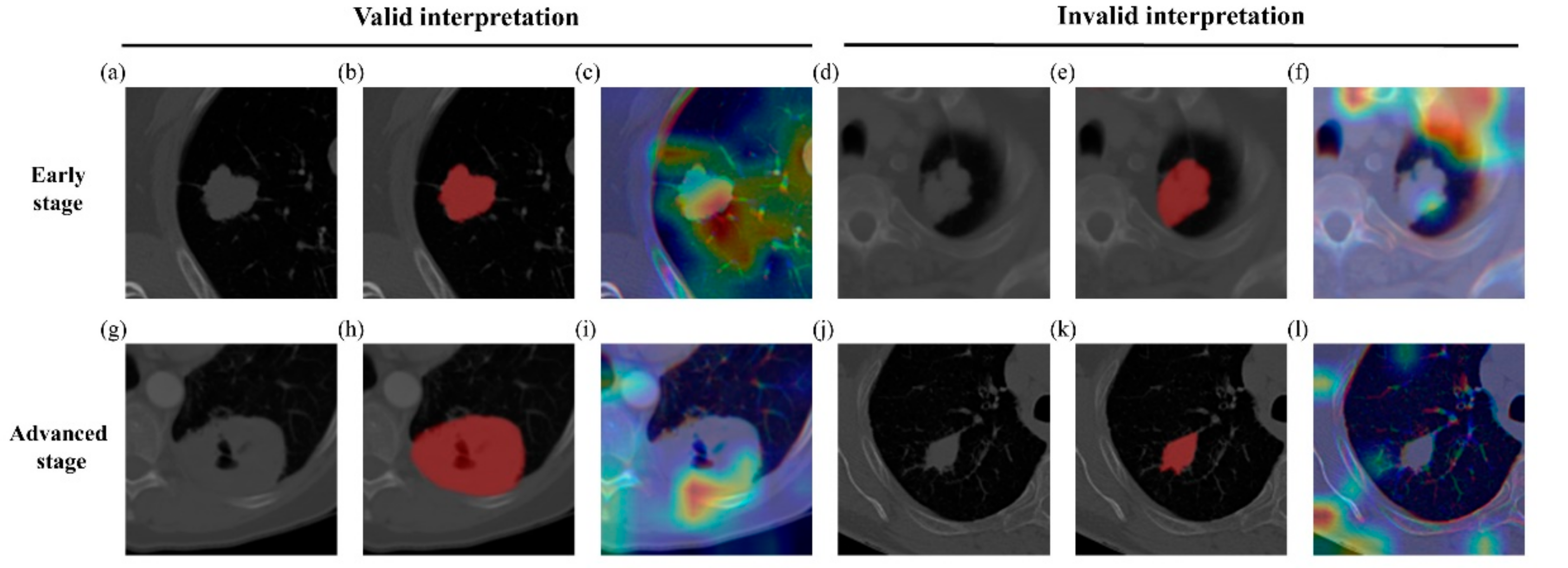 Diagnostics 11 01047 g005 Diagnostics 11 01047 g005