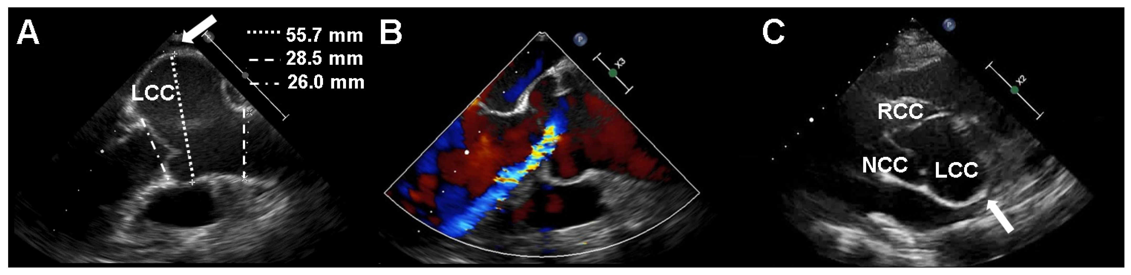 Diagnostics 11 01057 g001 Diagnostics 11 01057 g001