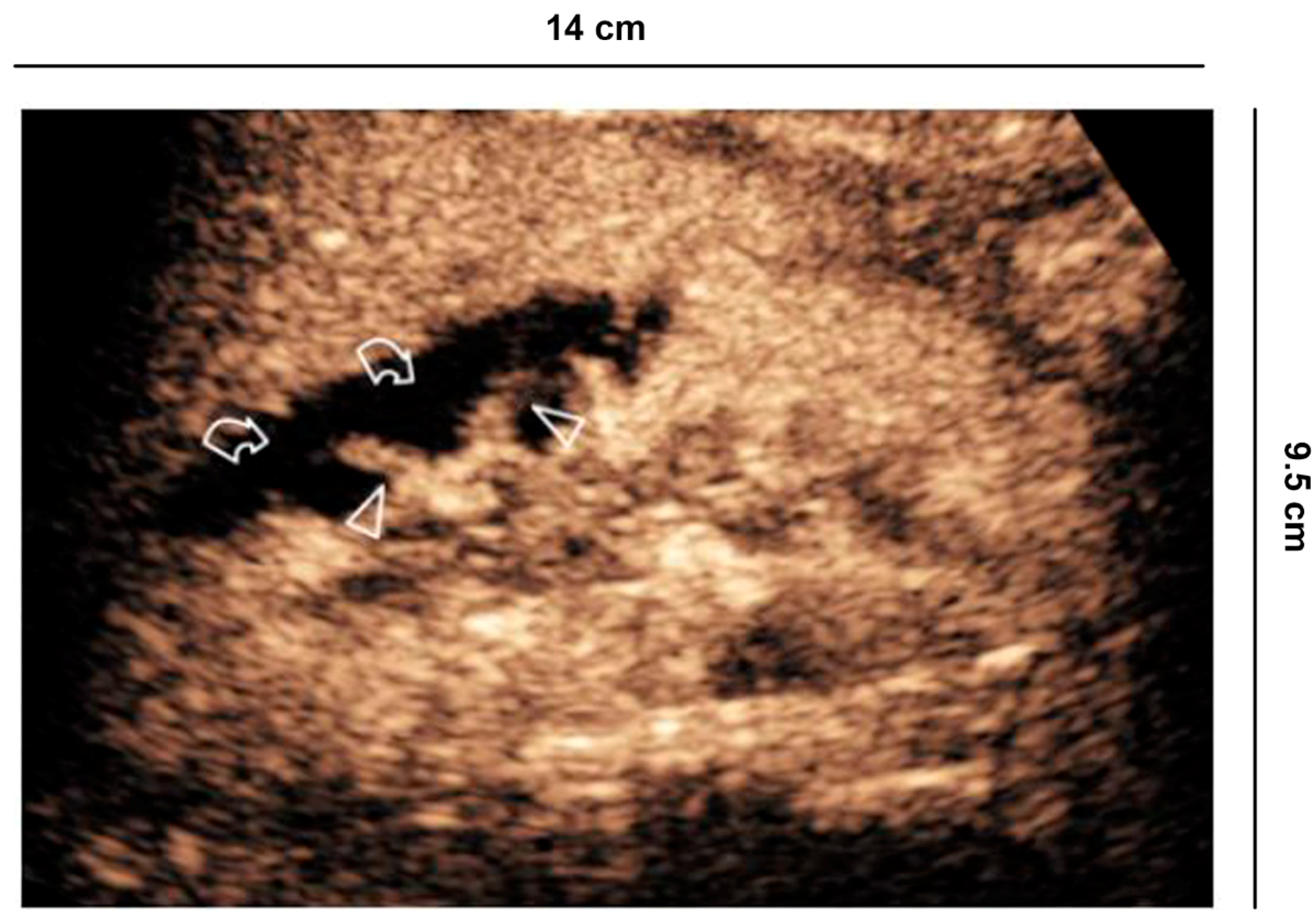 Diagnostics 11 01058 g008