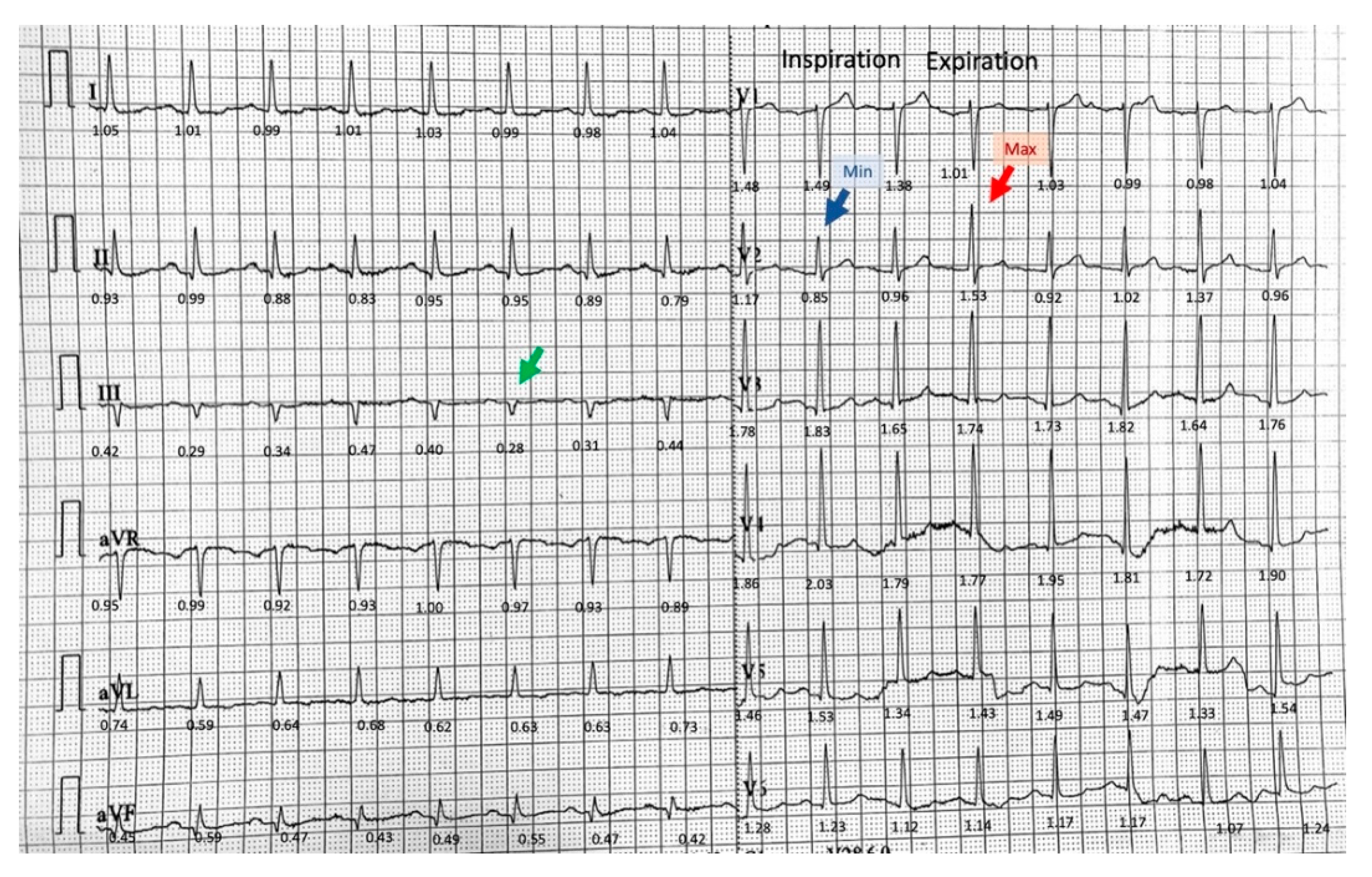 Diagnostics 11 01069 g001 Diagnostics 11 01069 g001