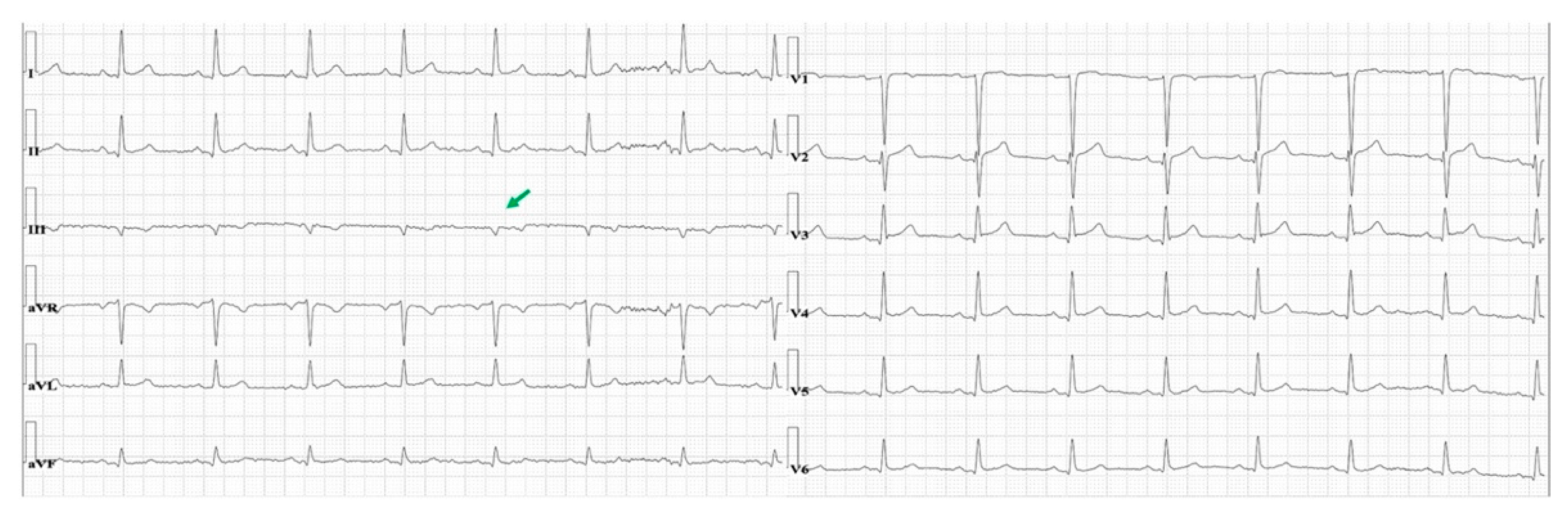 Diagnostics 11 01069 g003 Diagnostics 11 01069 g003