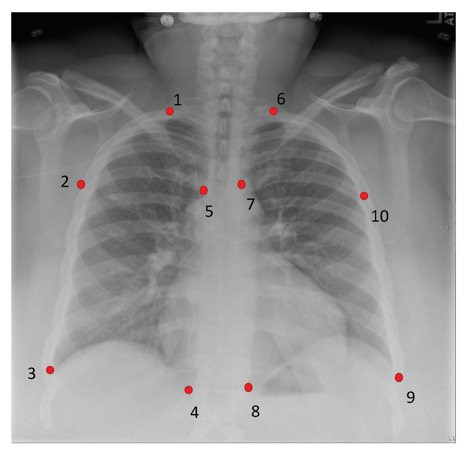 Diagnostics 11 01080 g005