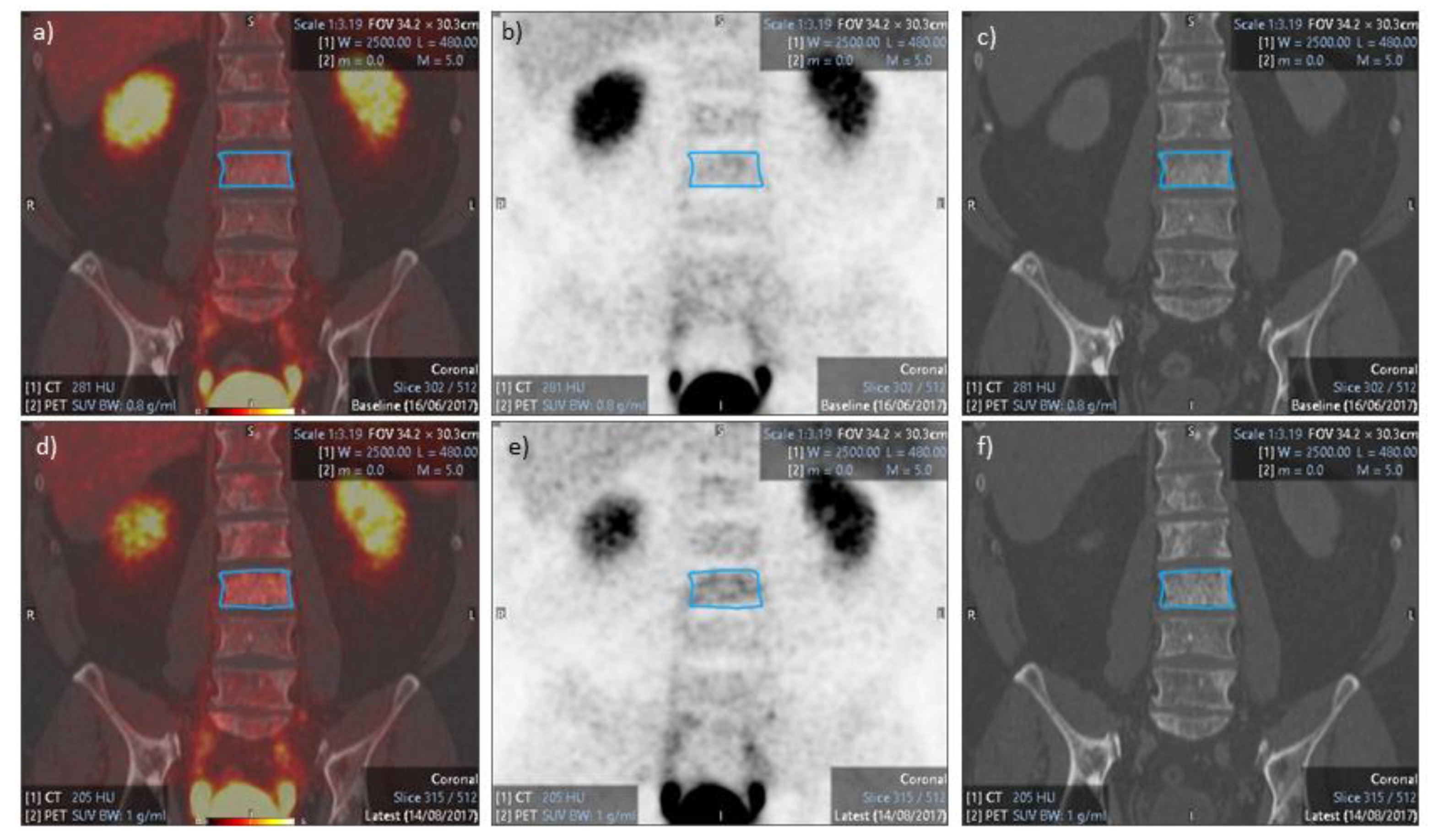 Diagnostics 11 01087 g003 Diagnostics 11 01087 g003