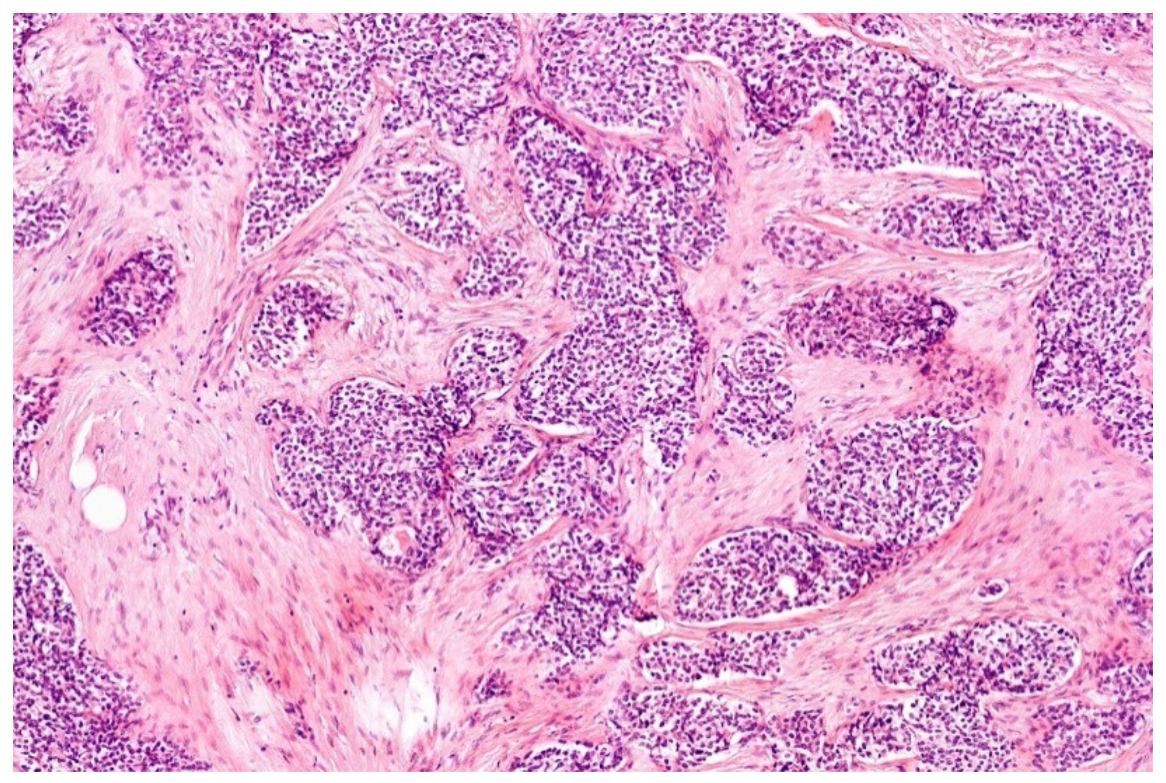 Diagnostics 11 01093 g004 Diagnostics 11 01093 g004