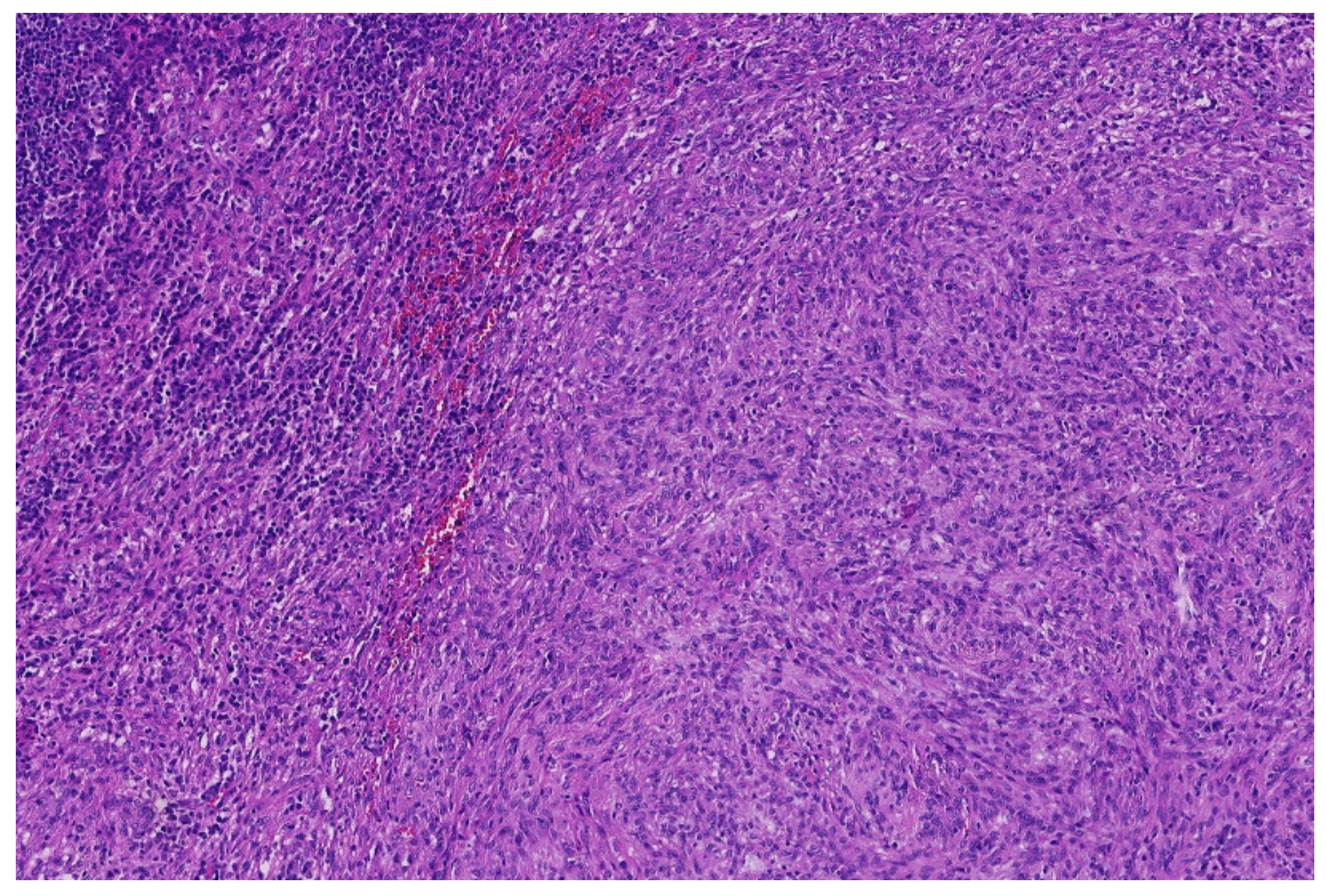 Diagnostics 11 01093 g006 Diagnostics 11 01093 g006