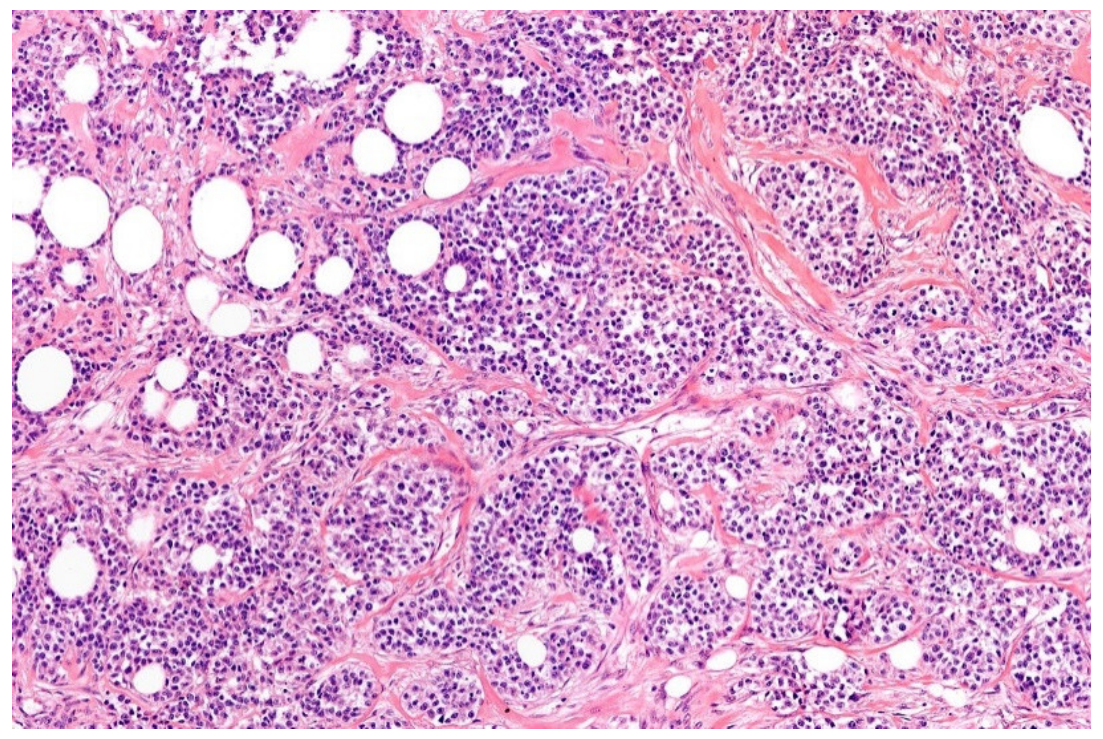 Diagnostics 11 01093 g008 Diagnostics 11 01093 g008