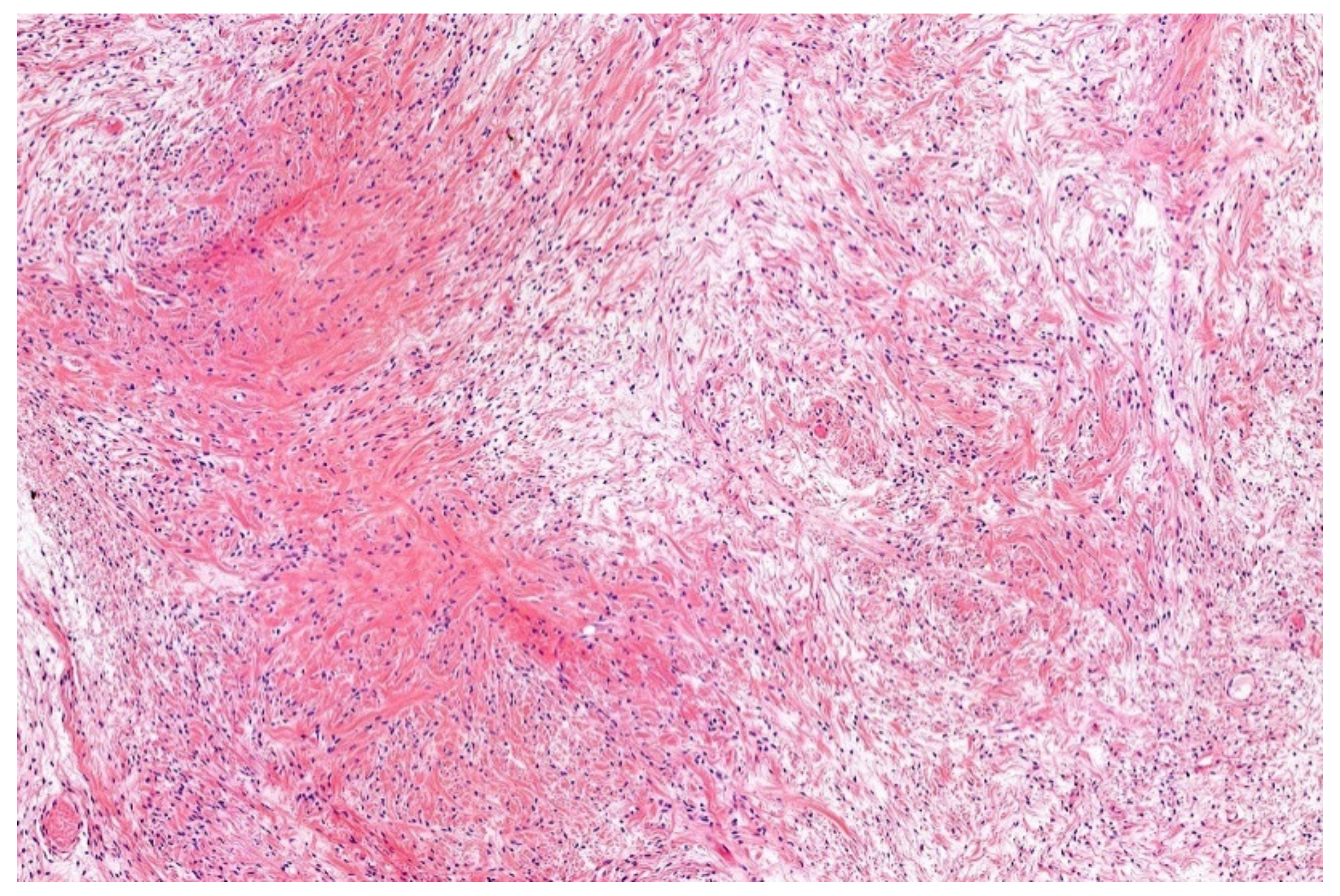 Diagnostics 11 01093 g011 Diagnostics 11 01093 g011