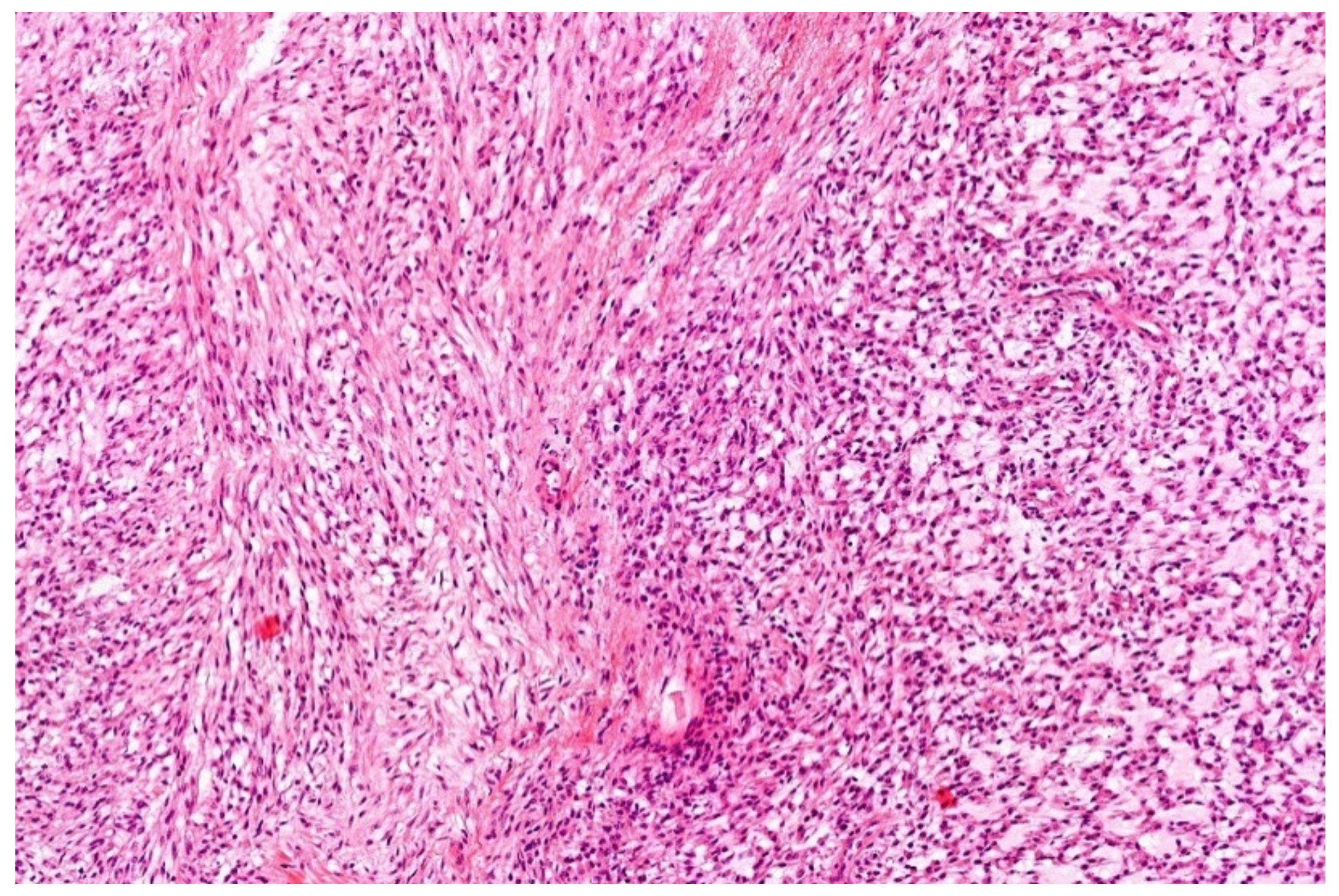 Diagnostics 11 01093 g013 Diagnostics 11 01093 g013