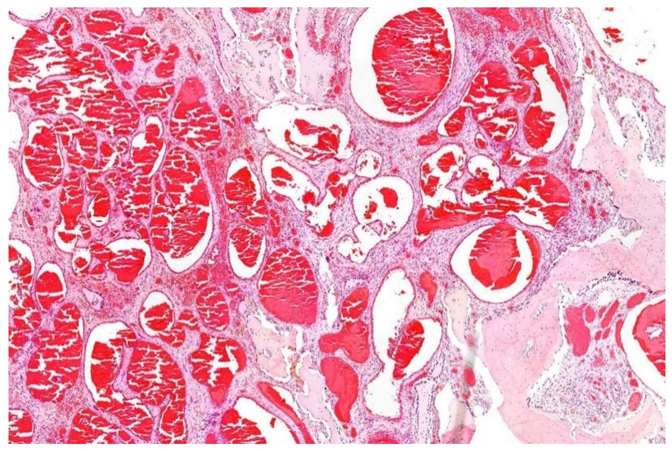 Diagnostics 11 01093 g016 Diagnostics 11 01093 g016