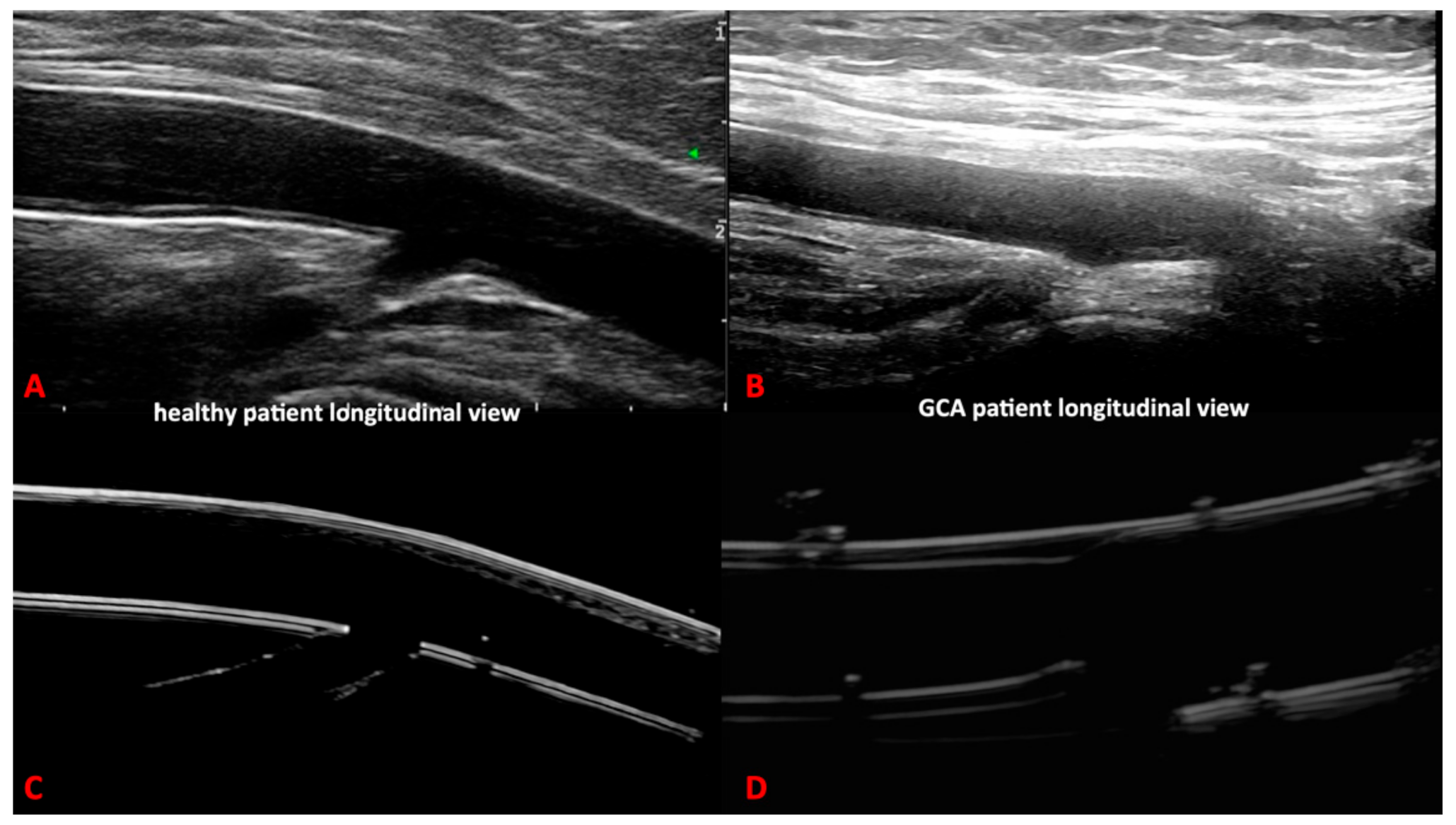 Diagnostics 11 01106 g004