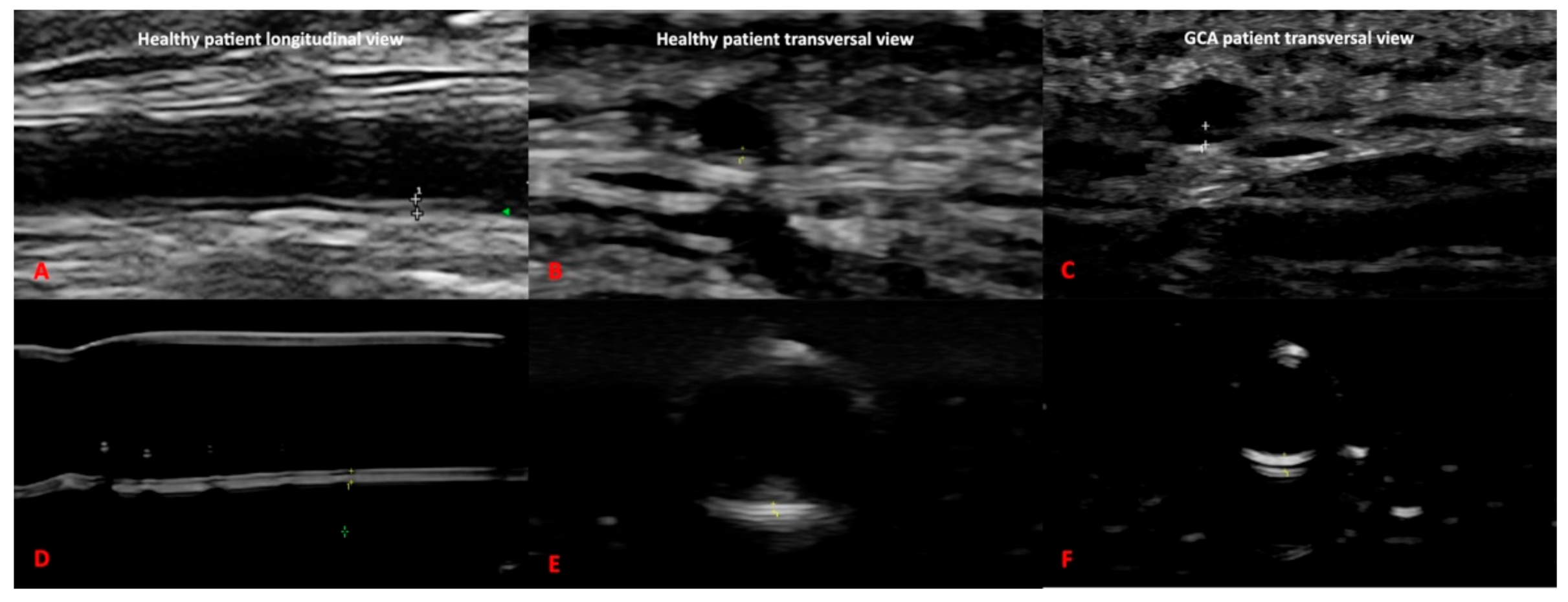 Diagnostics 11 01106 g005