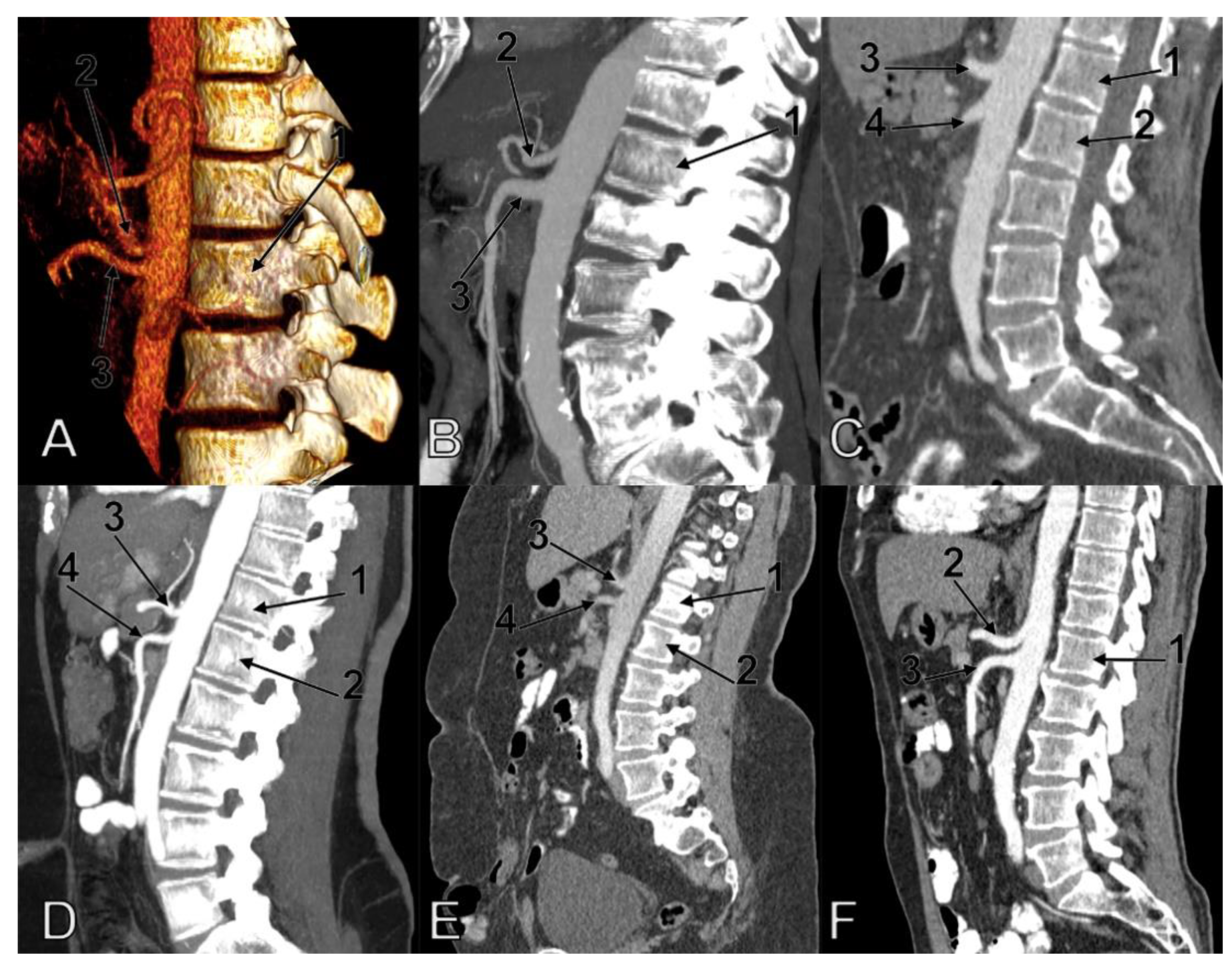 Diagnostics 11 01111 g002 Diagnostics 11 01111 g002