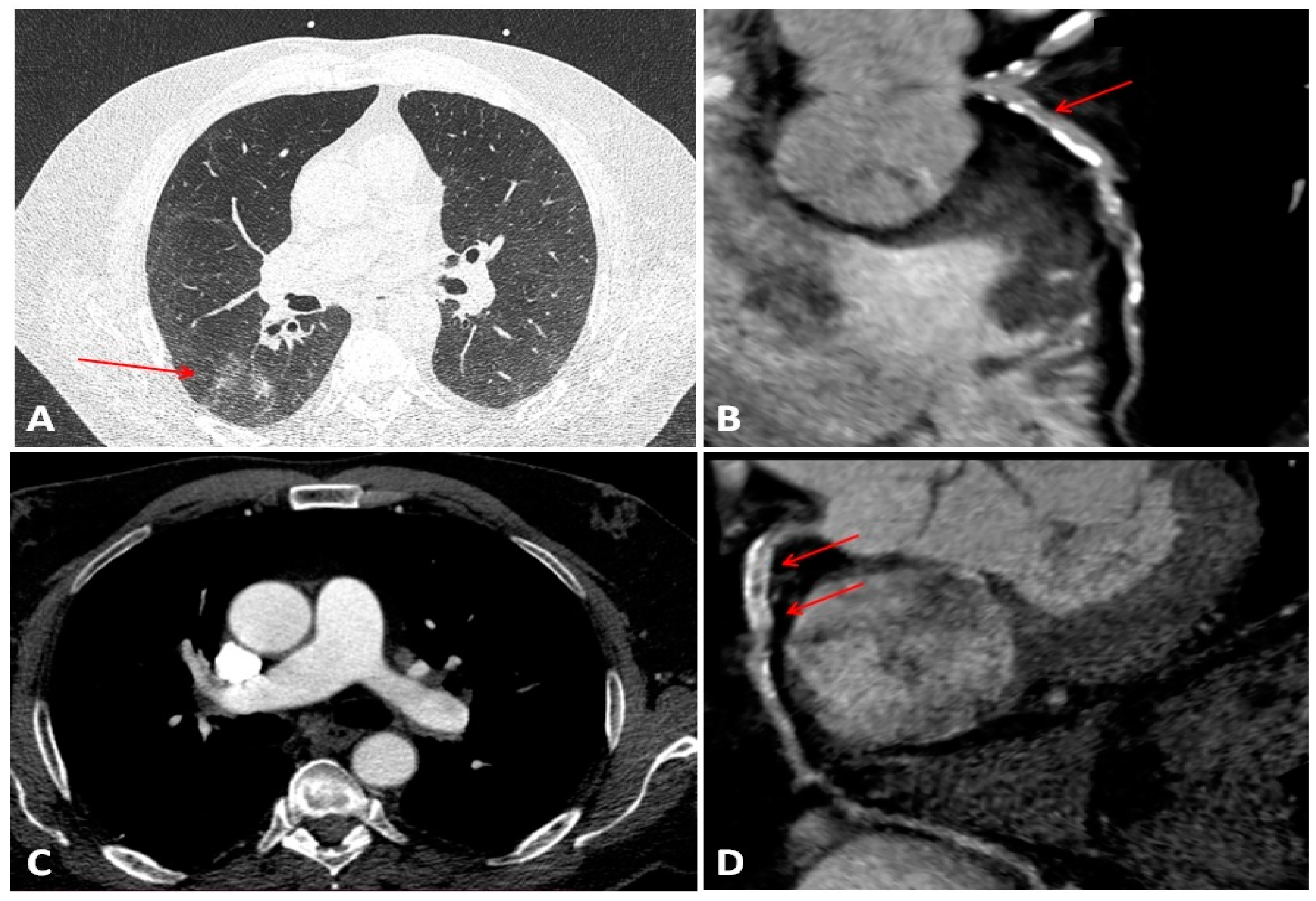 Diagnostics 11 01114 g002 Diagnostics 11 01114 g002