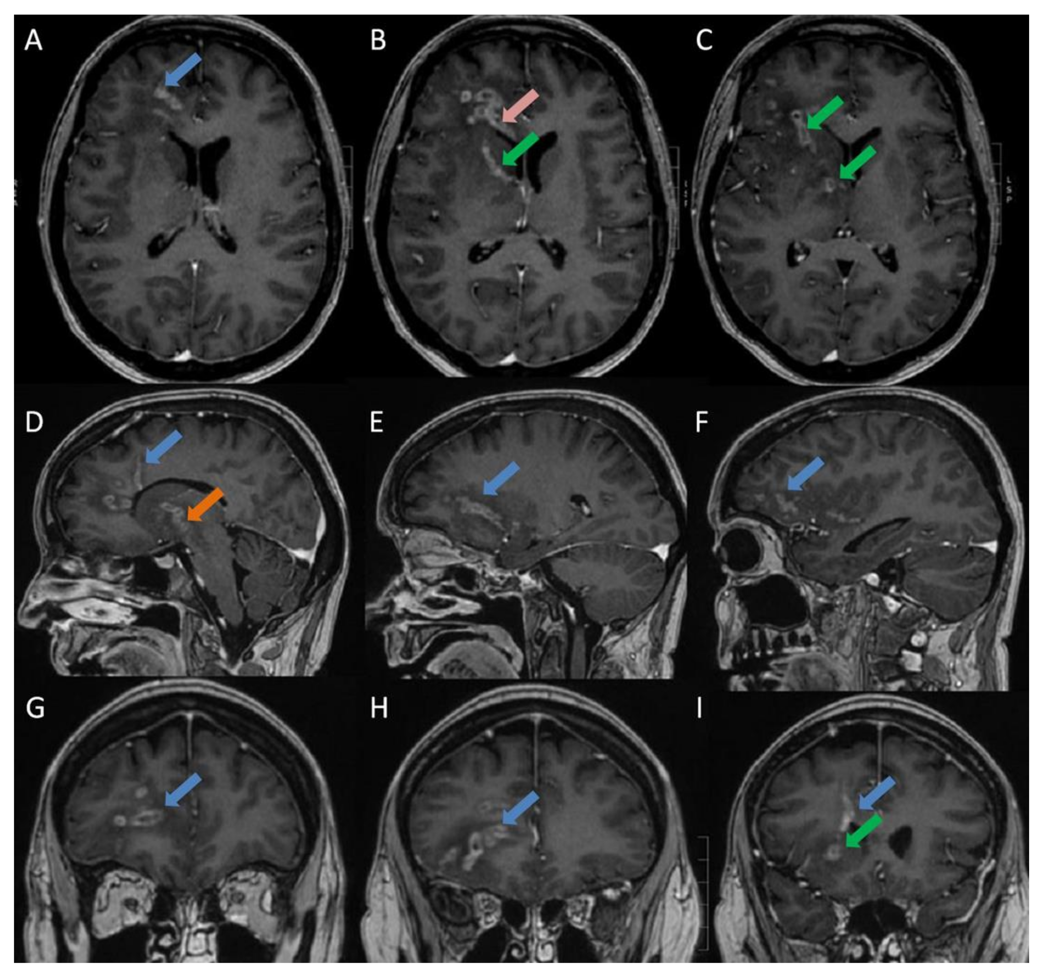 Diagnostics 11 01115 g001
