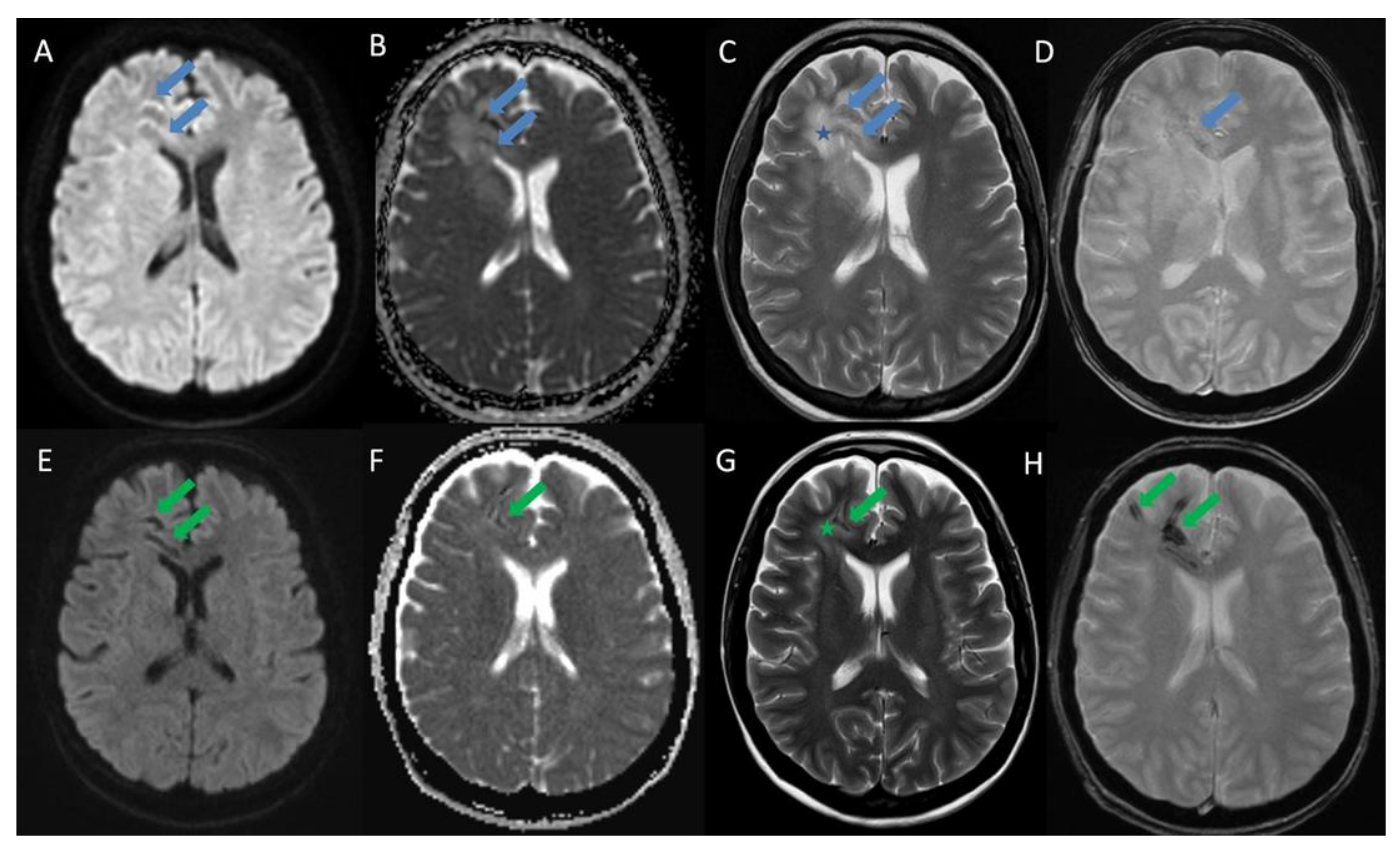 Diagnostics 11 01115 g002