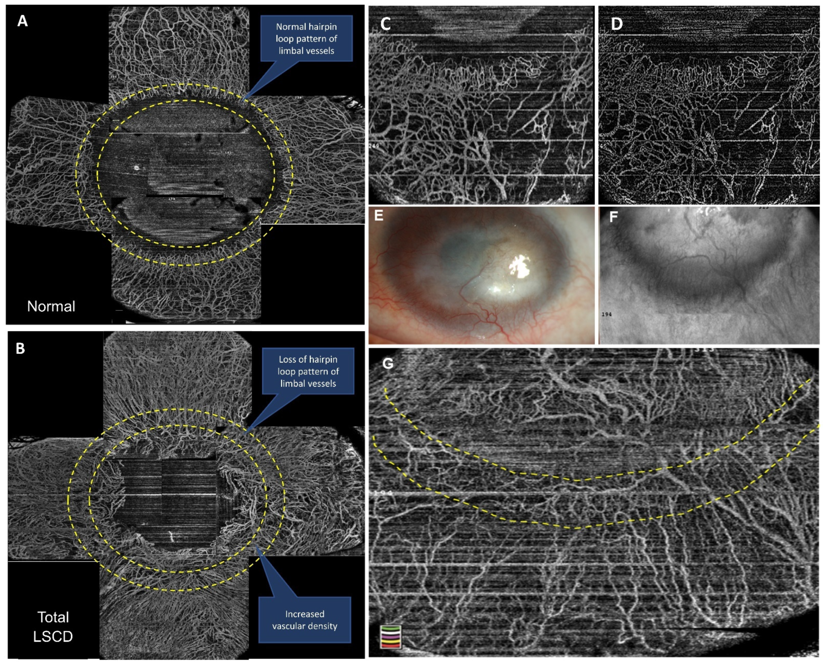 Diagnostics 11 01130 g003