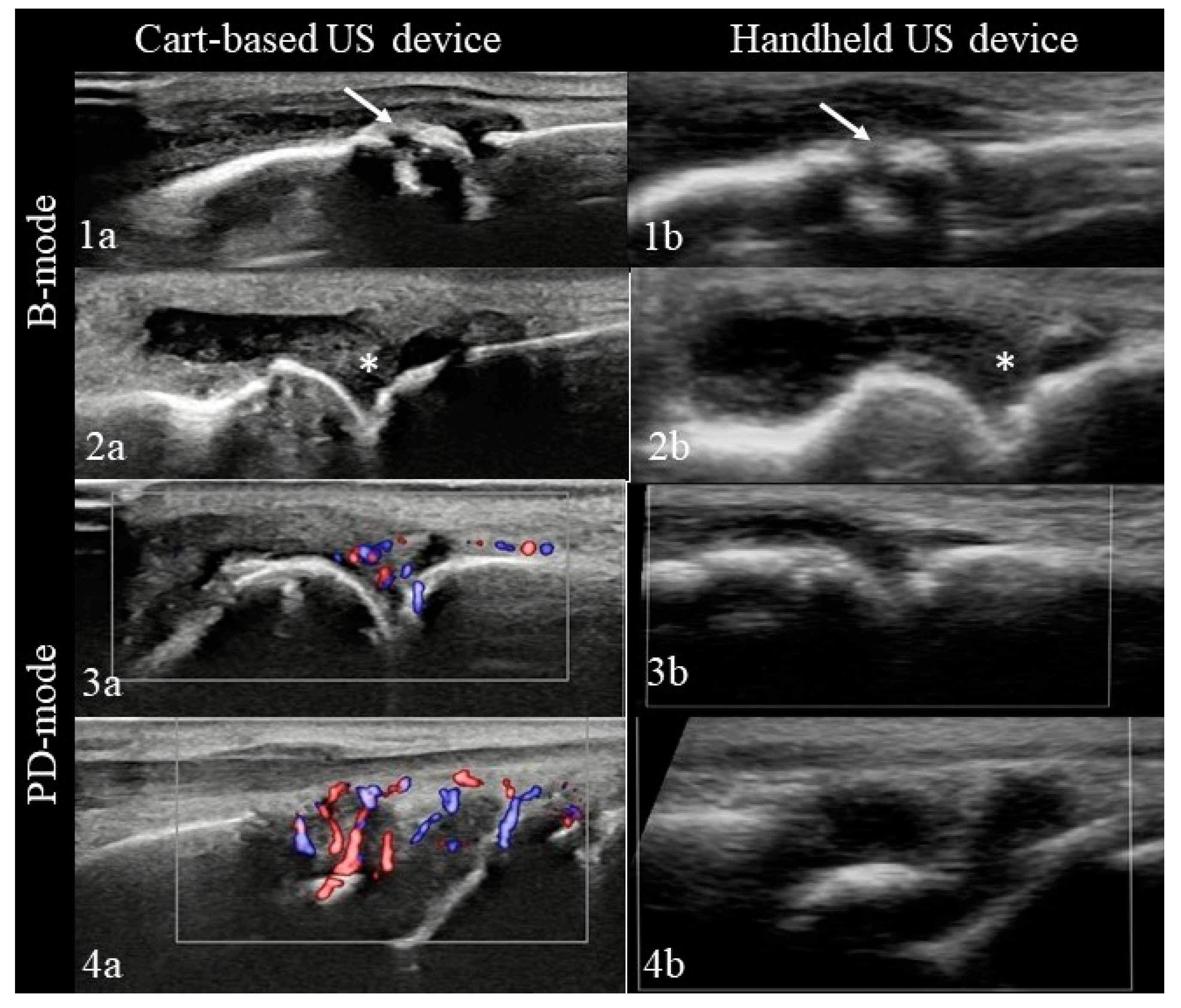 Diagnostics 11 01139 g002 550