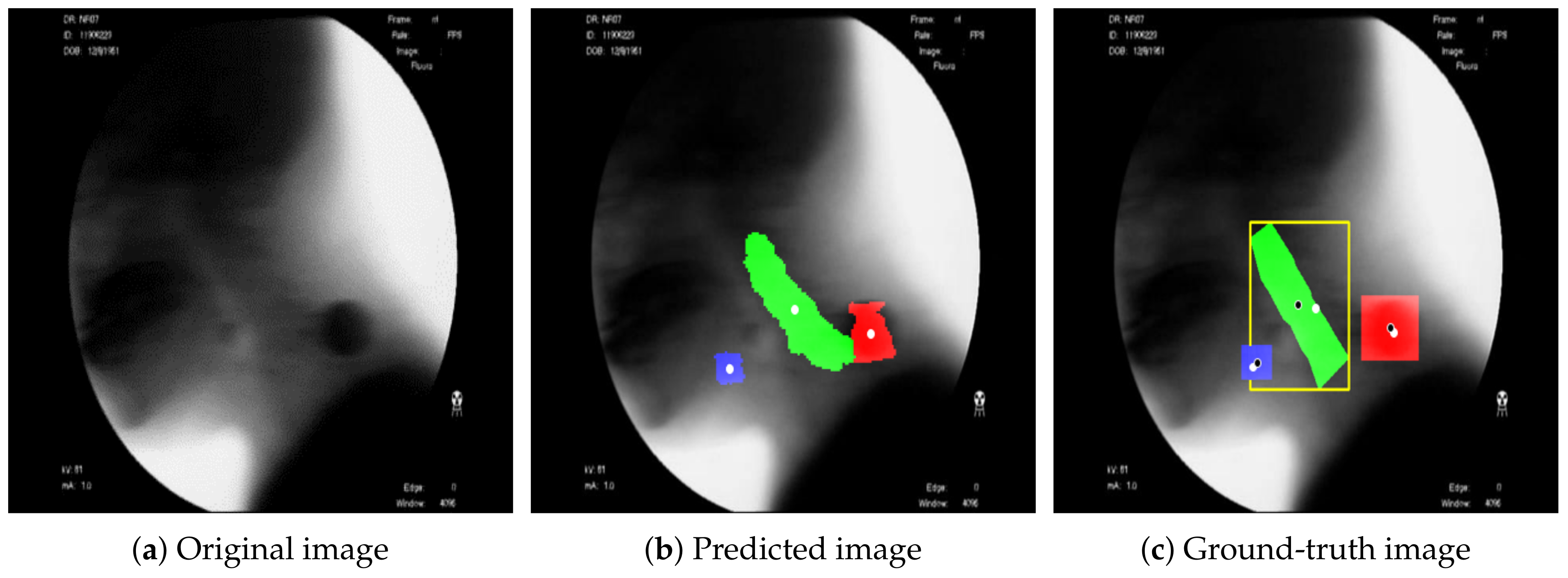 Diagnostics 11 01147 g003 550