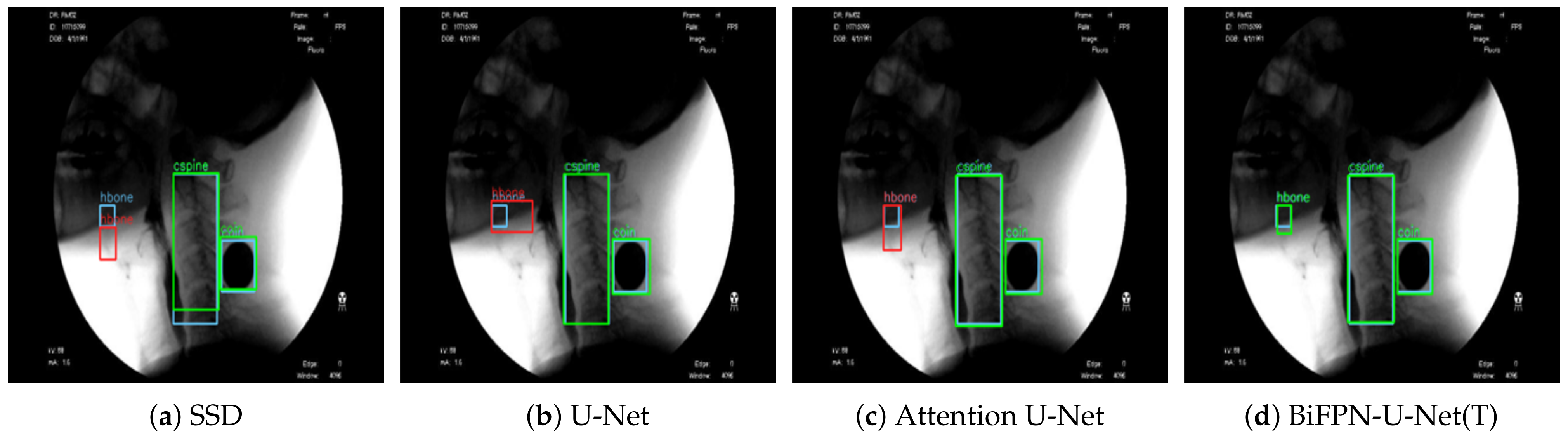 Diagnostics 11 01147 g004 550