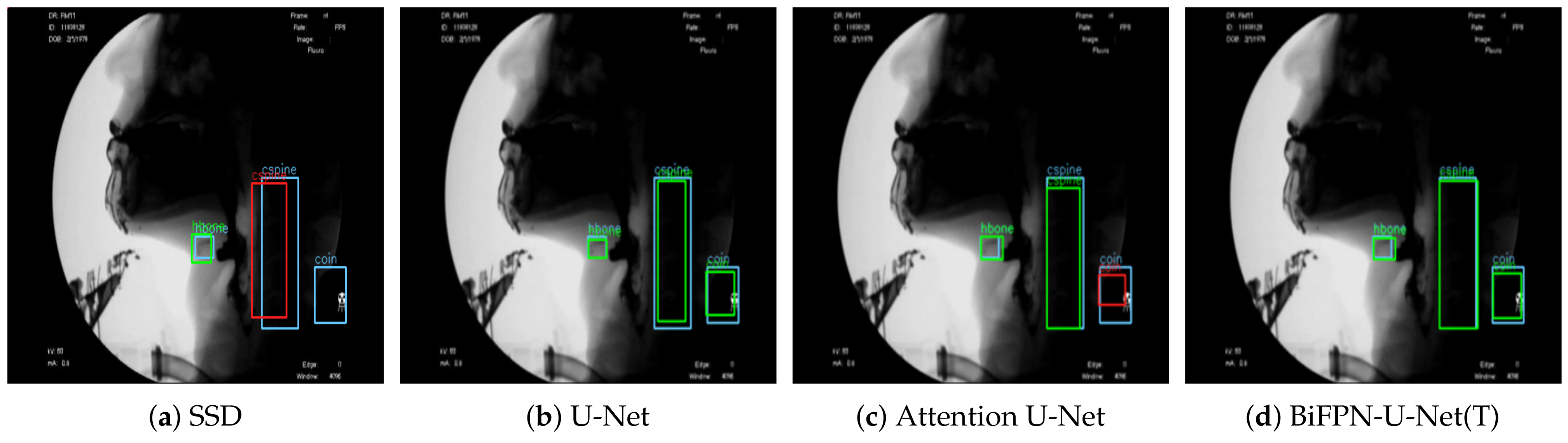 Diagnostics 11 01147 g007 550