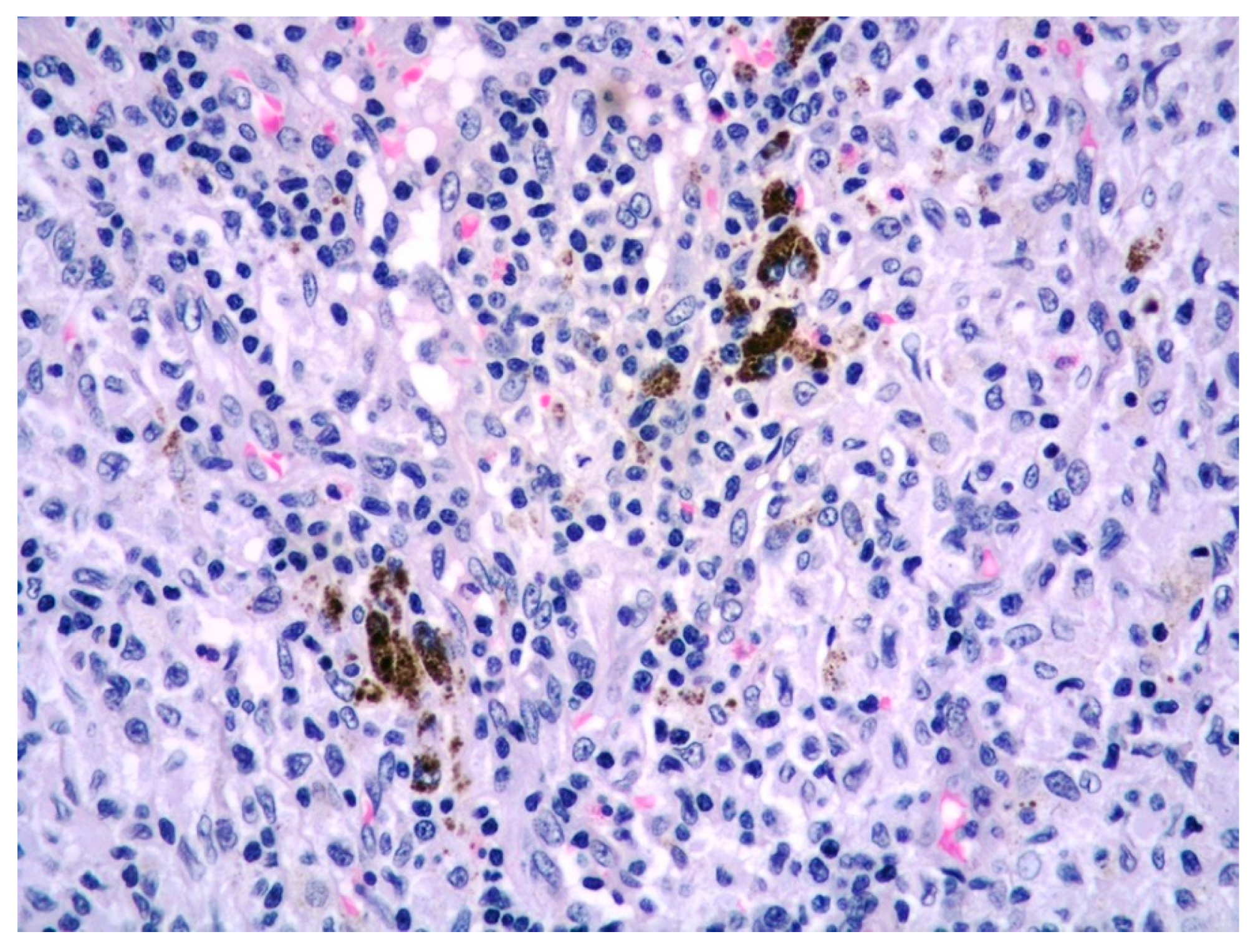 Diagnostics 11 01150 g002 550