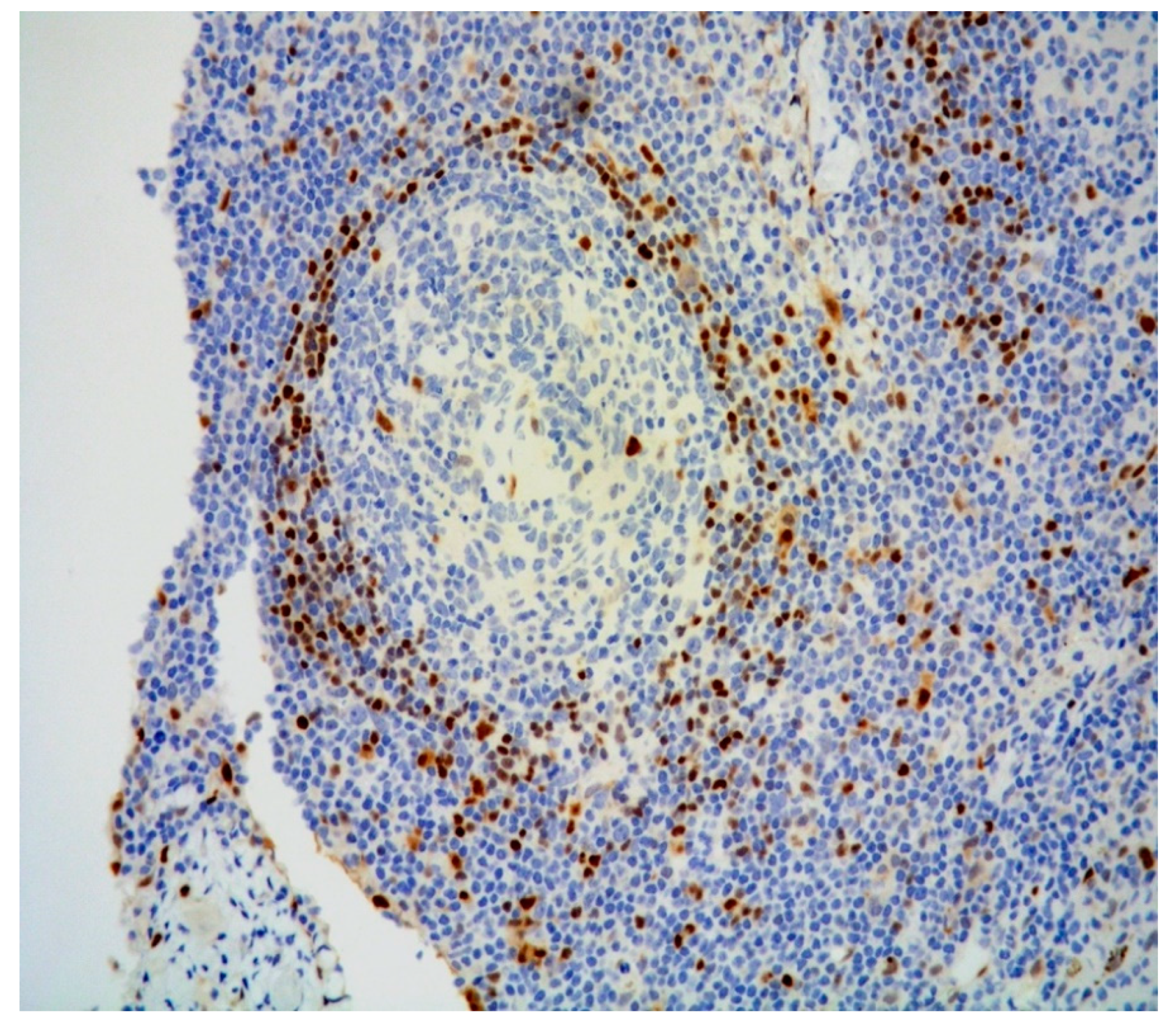 Diagnostics 11 01150 g005 550