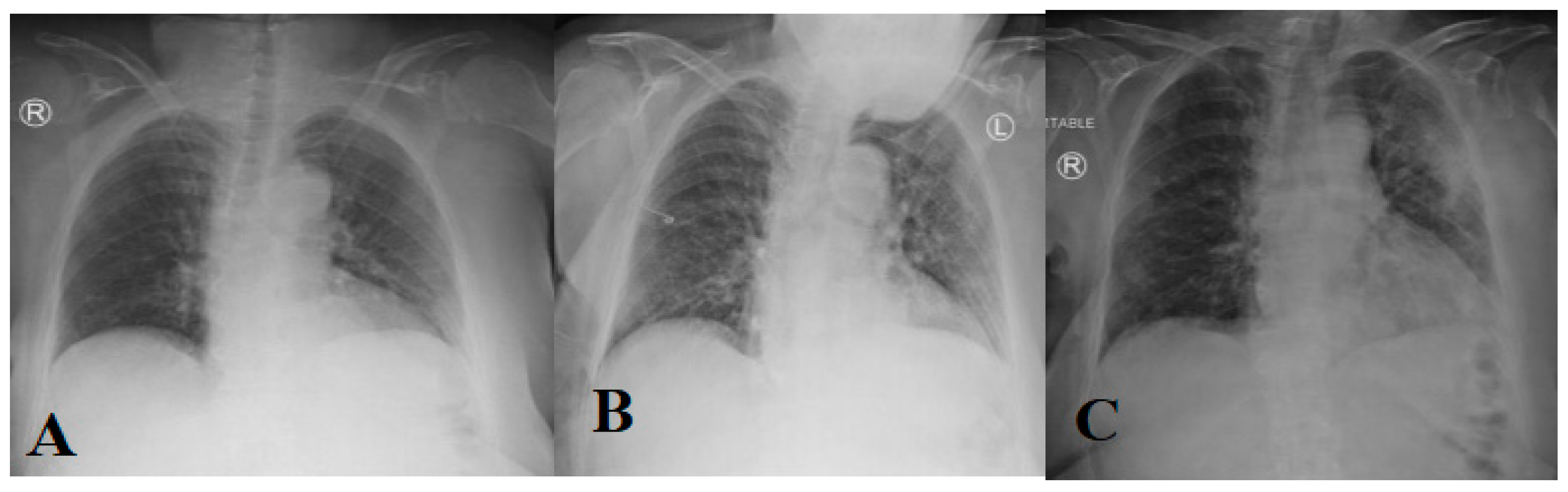 Diagnostics Free Full-Text Comprehensive Survey of Using Machine Learning in the COVID-19 Pandemic photo