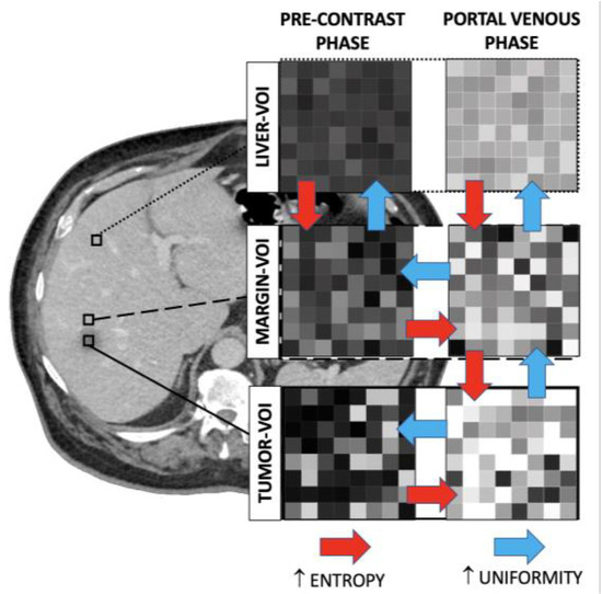 MAセット3枚 Contrast Administration Impacts CT-Based Radiomics of Colorectal