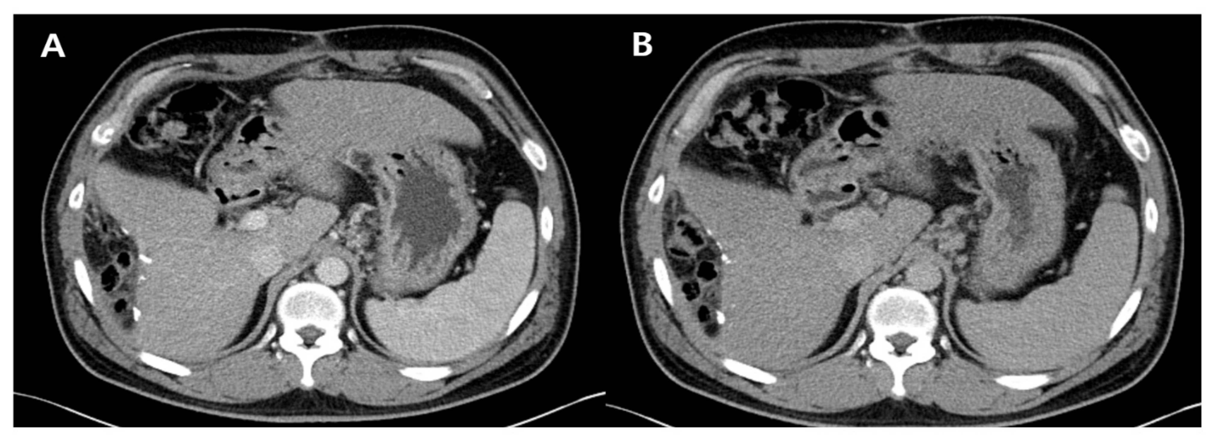 Diagnostics 11 01171 g003 550