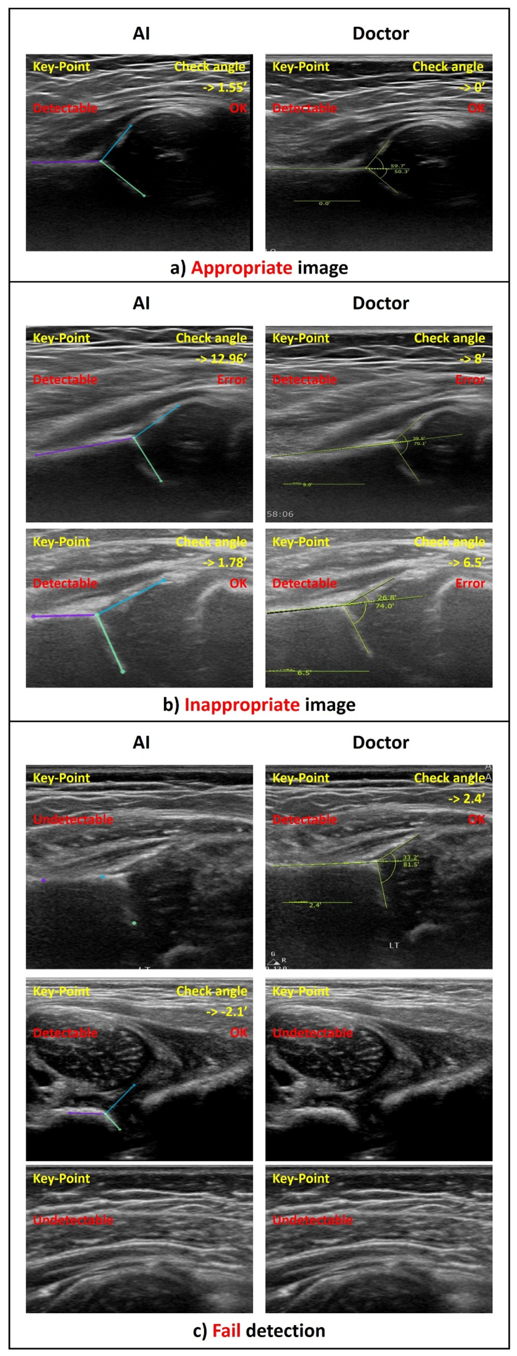Diagnostics 11 01174 g008 Diagnostics 11 01174 g008