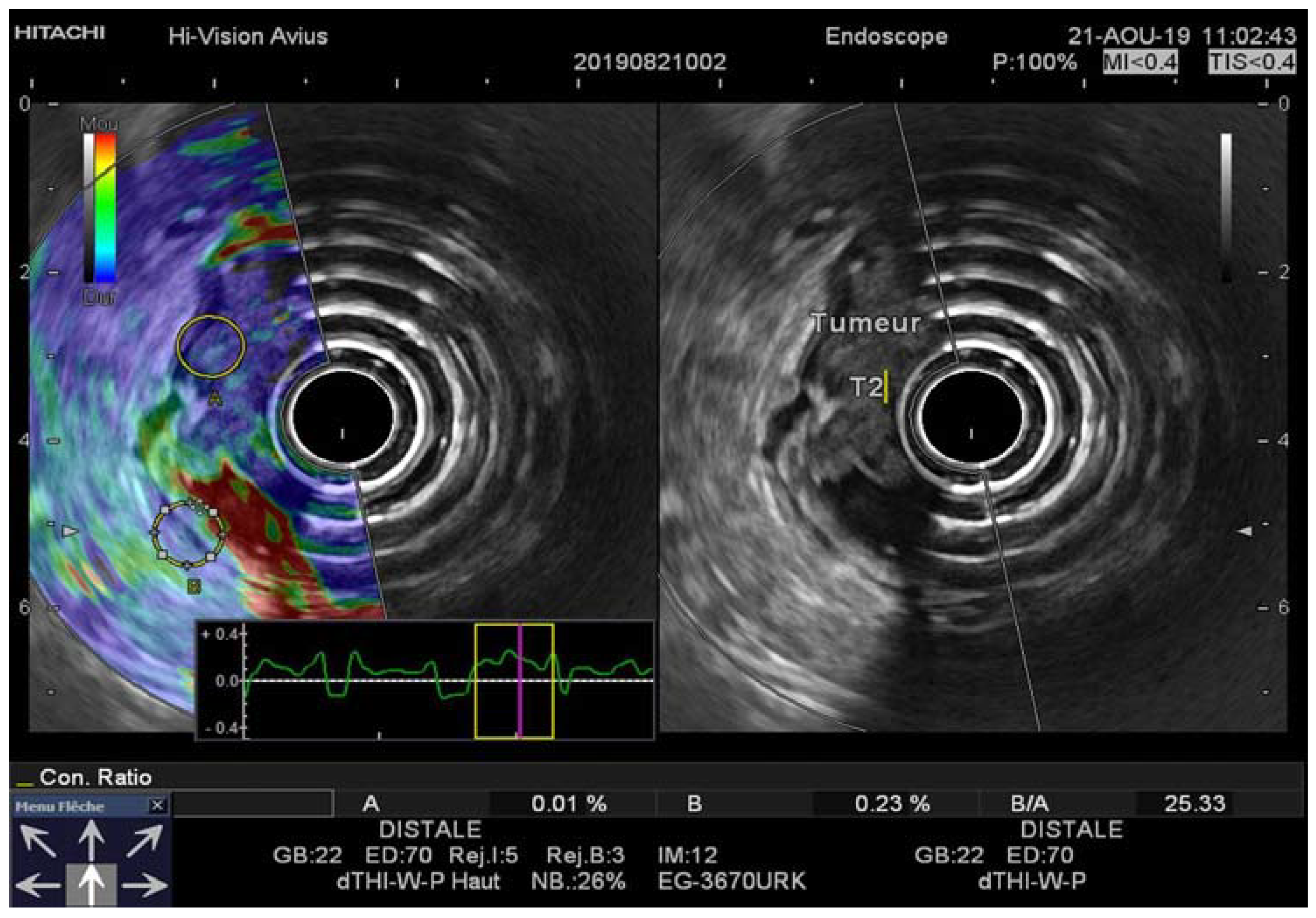 Diagnostics 11 01180 g002