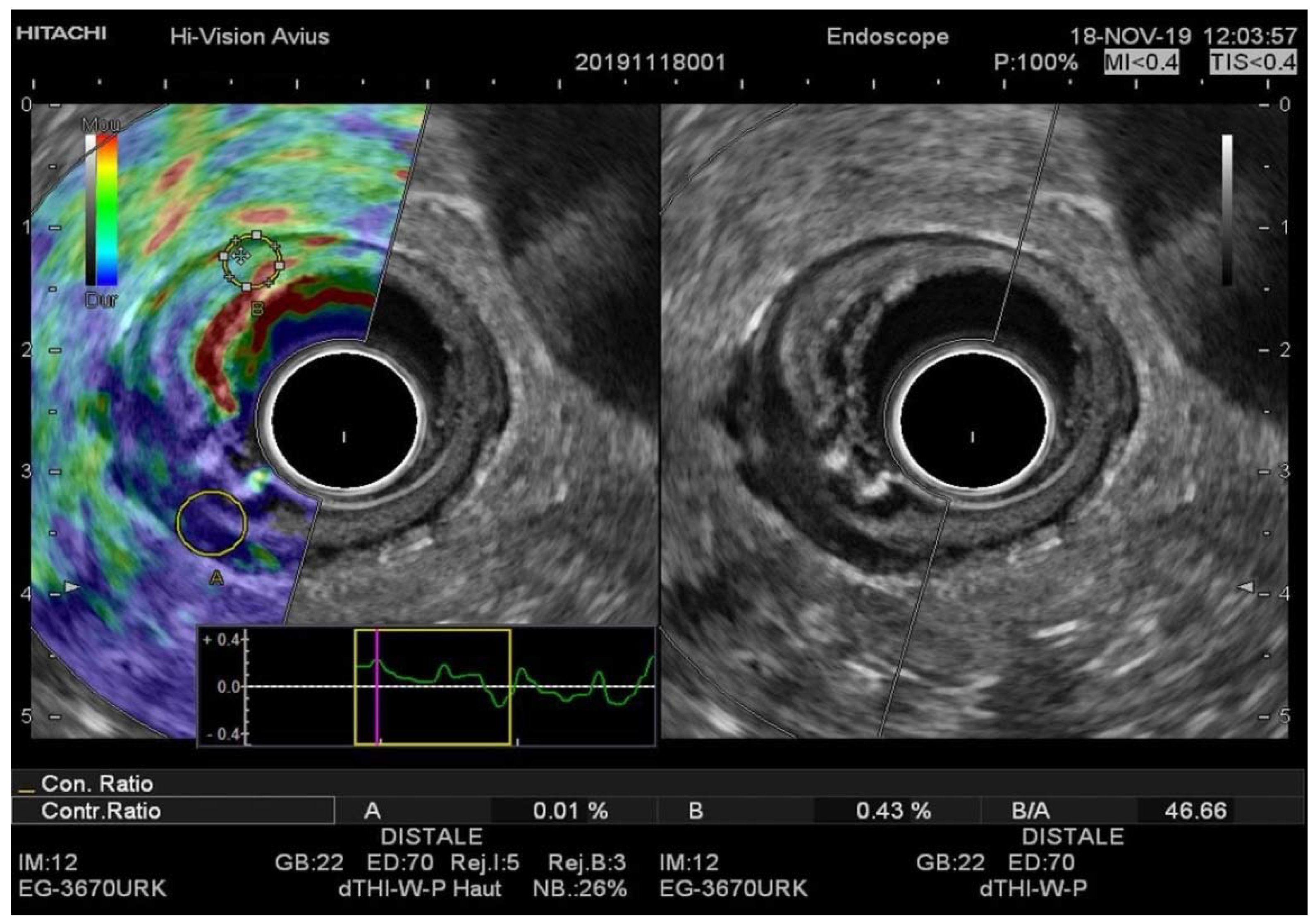 Diagnostics 11 01180 g003