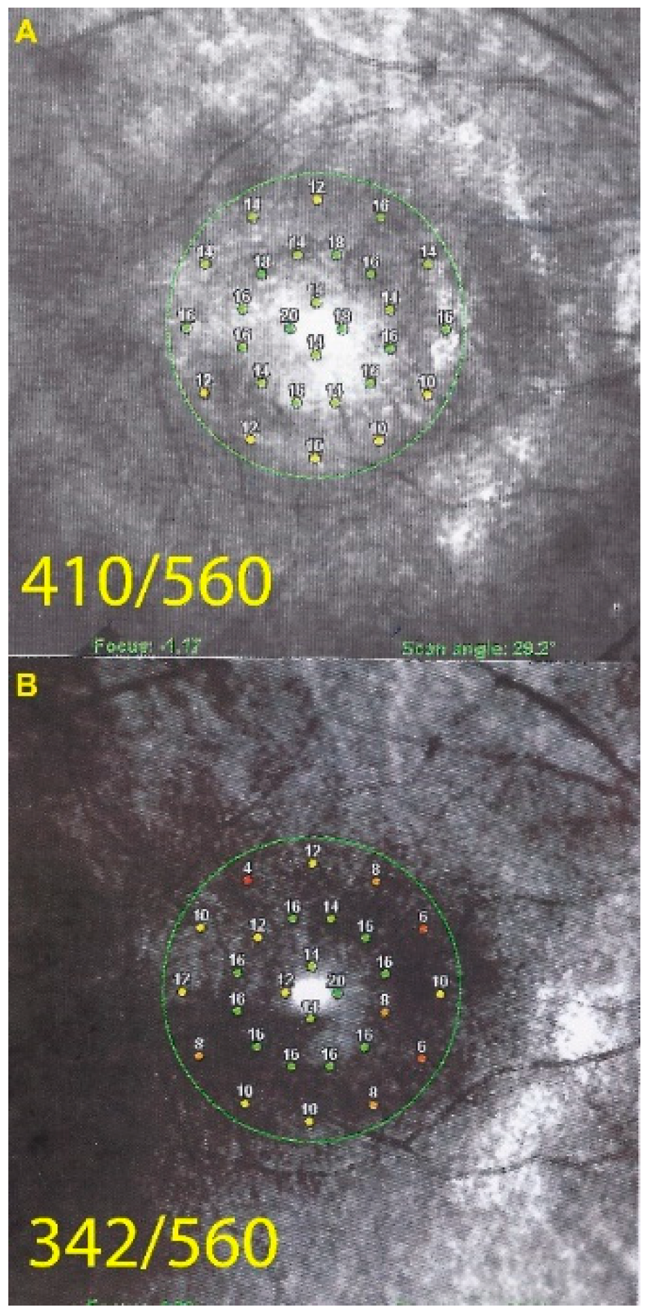 Diagnostics 11 01184 g004 550
