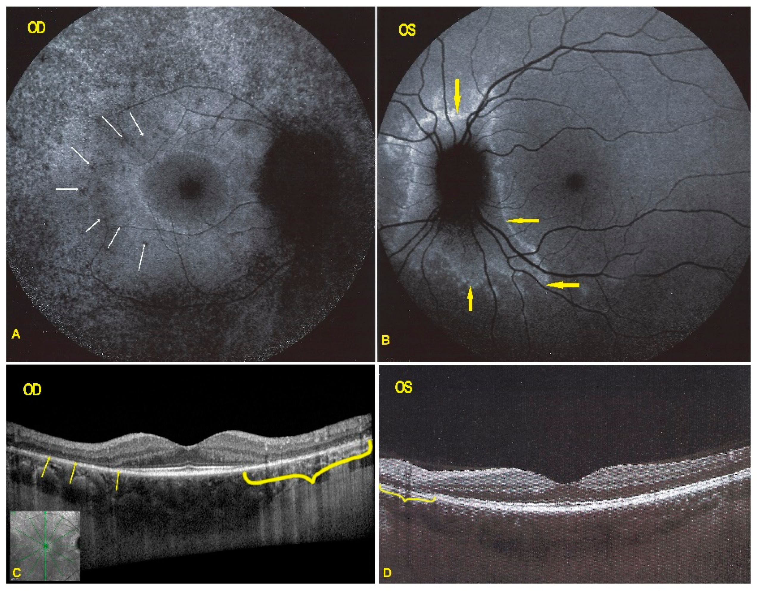 Diagnostics 11 01184 g006 550