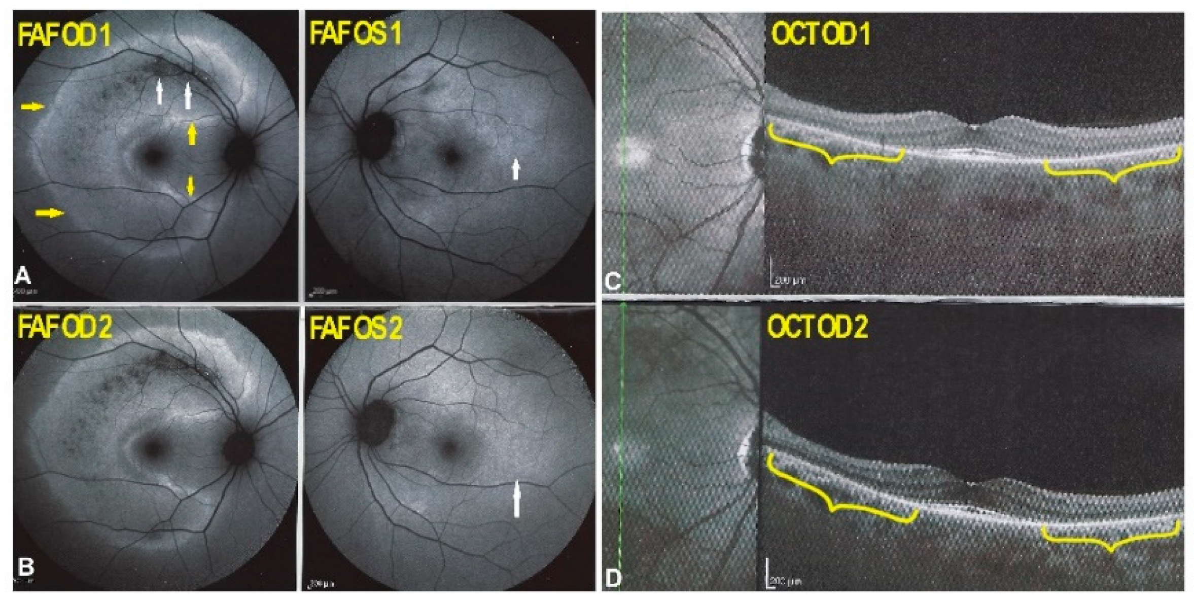 Diagnostics 11 01184 g008 550