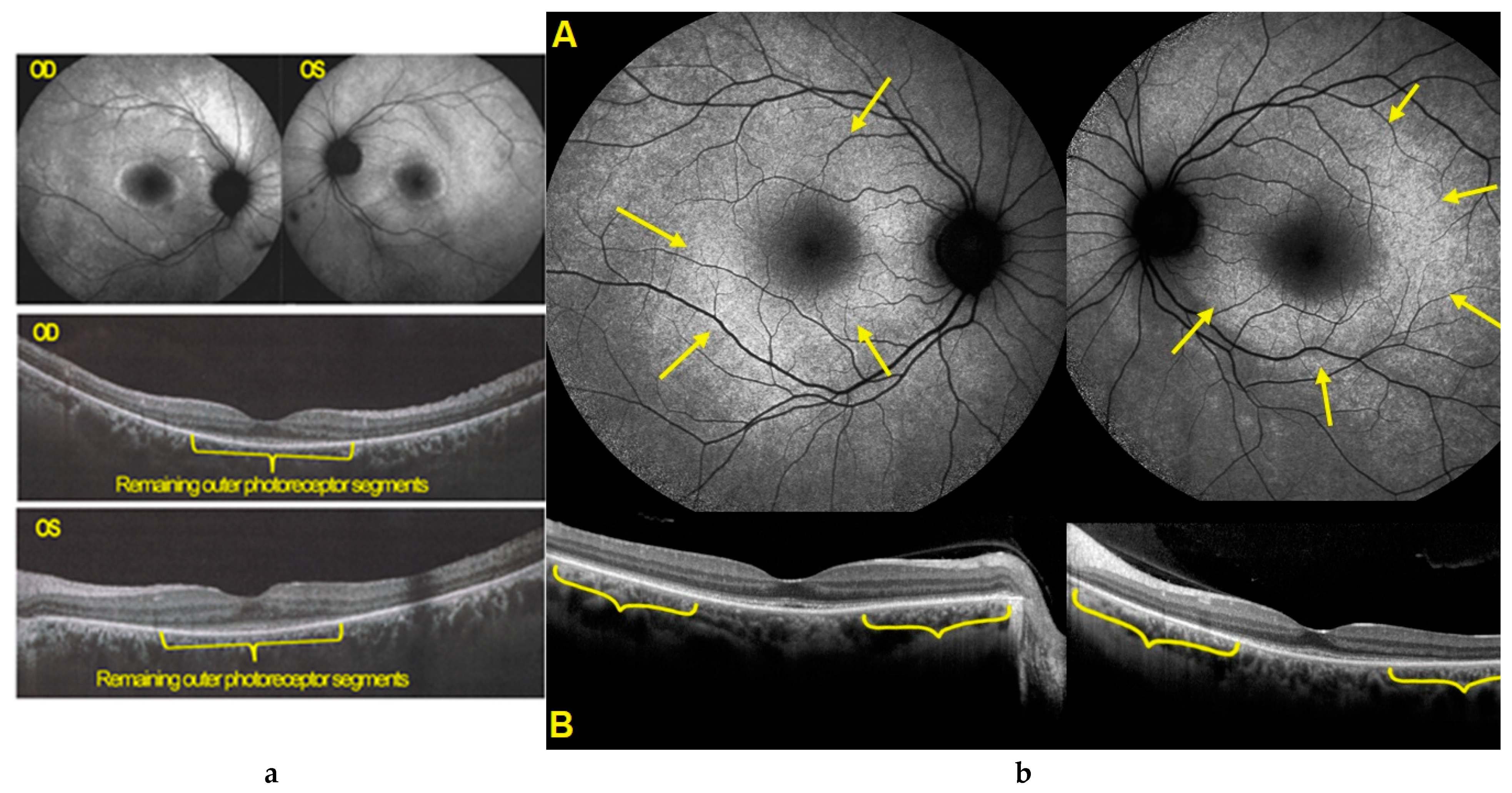 Diagnostics 11 01184 g011 550