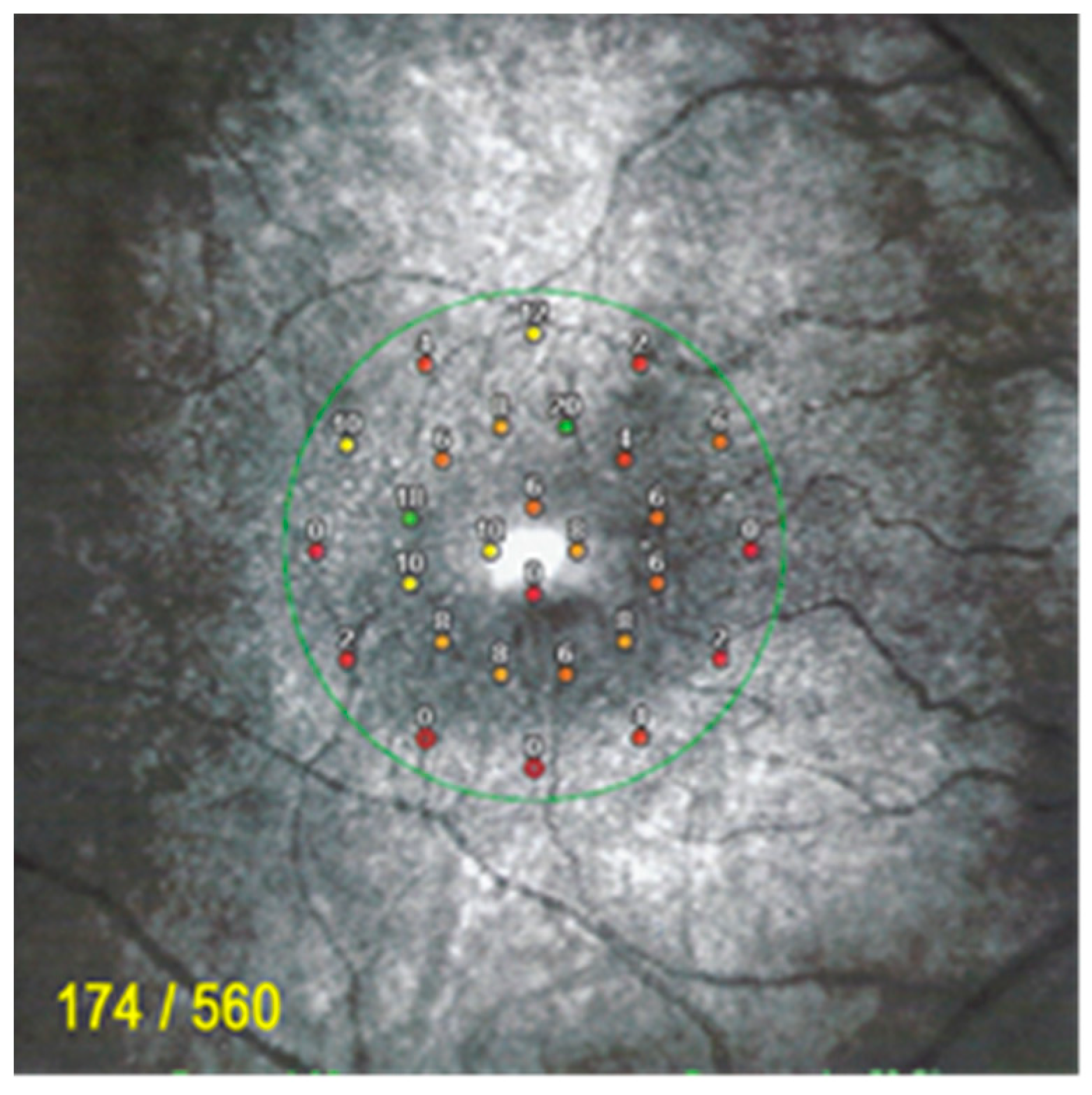 Diagnostics 11 01184 g013 550