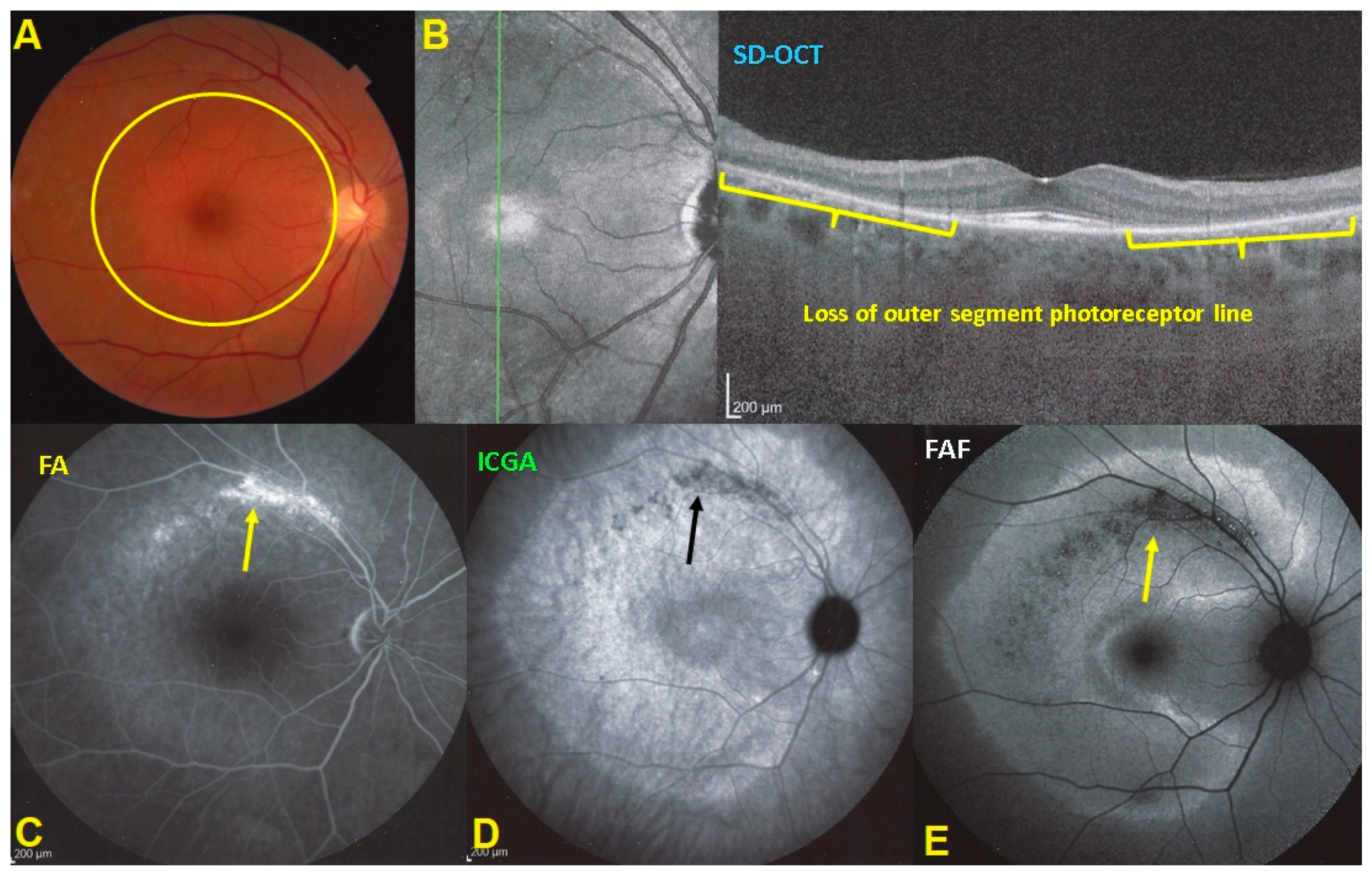 Diagnostics 11 01184 g014 550